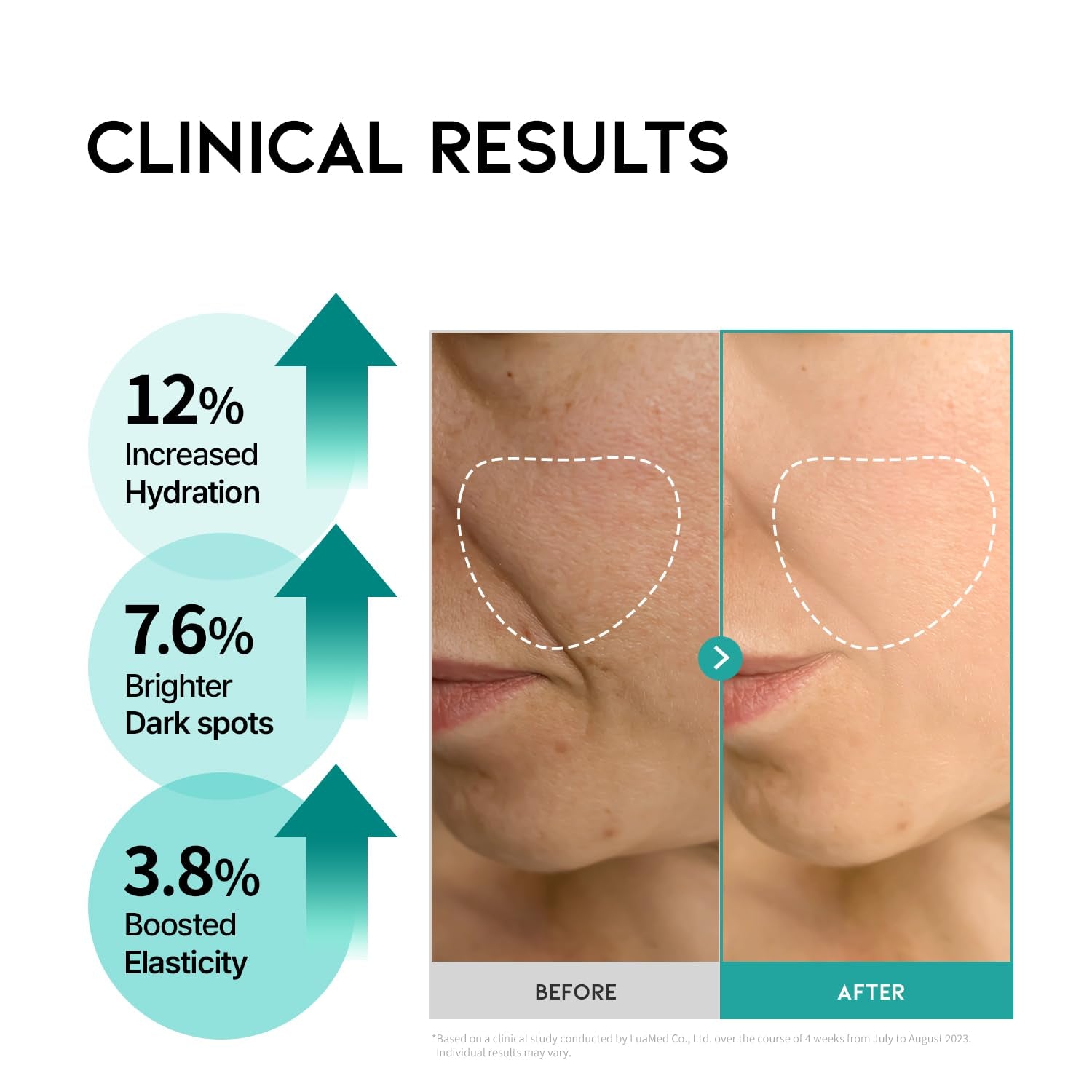 #OOTD R+ Wrinkle Lift Retinol Serum - 50ml