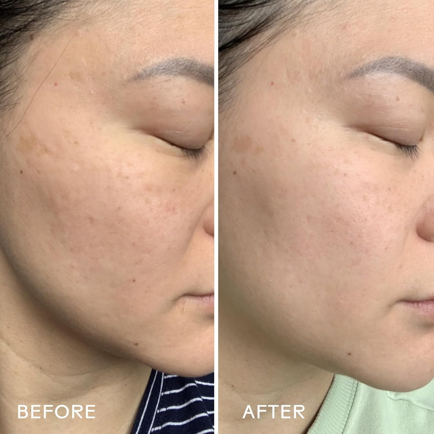 - Jelly Drops Kakadu Plum + Mushroom Hyaluronic Acid Serum | Hydrate, Replenish, Plump Skin | Cruelty-Free, Vegan, Paraben-Free, Sensitive Skin Safe (1 Fl Oz | 30 Ml)