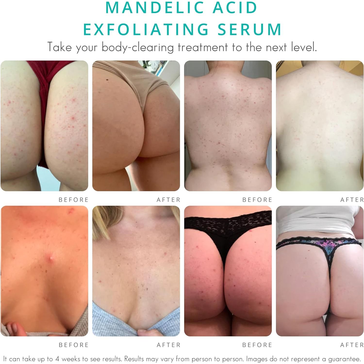 Almond Clear Exfoliating Serum For The Body, Level 2  - 118ml