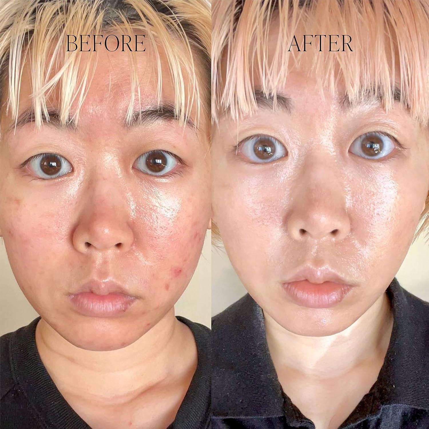 BYROE Basil Dark Spot Correcting Cream – 30ml | Dark Spot Fading, Calming & Hydrating