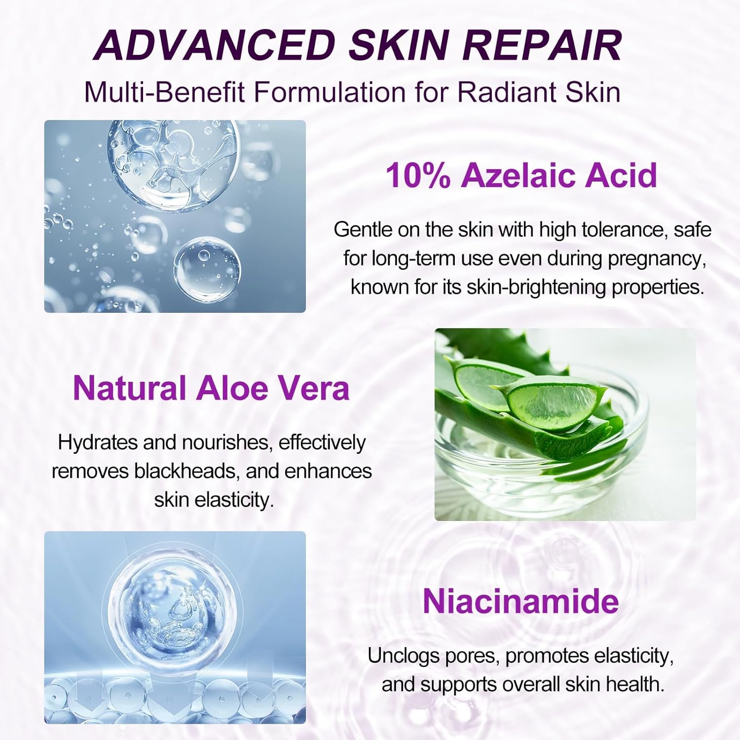 Netwik Azelaic Acid 10% Serum – 30ml | Redness Relief, Rosacea & Acne Treatment for Clear, Radiant Skin