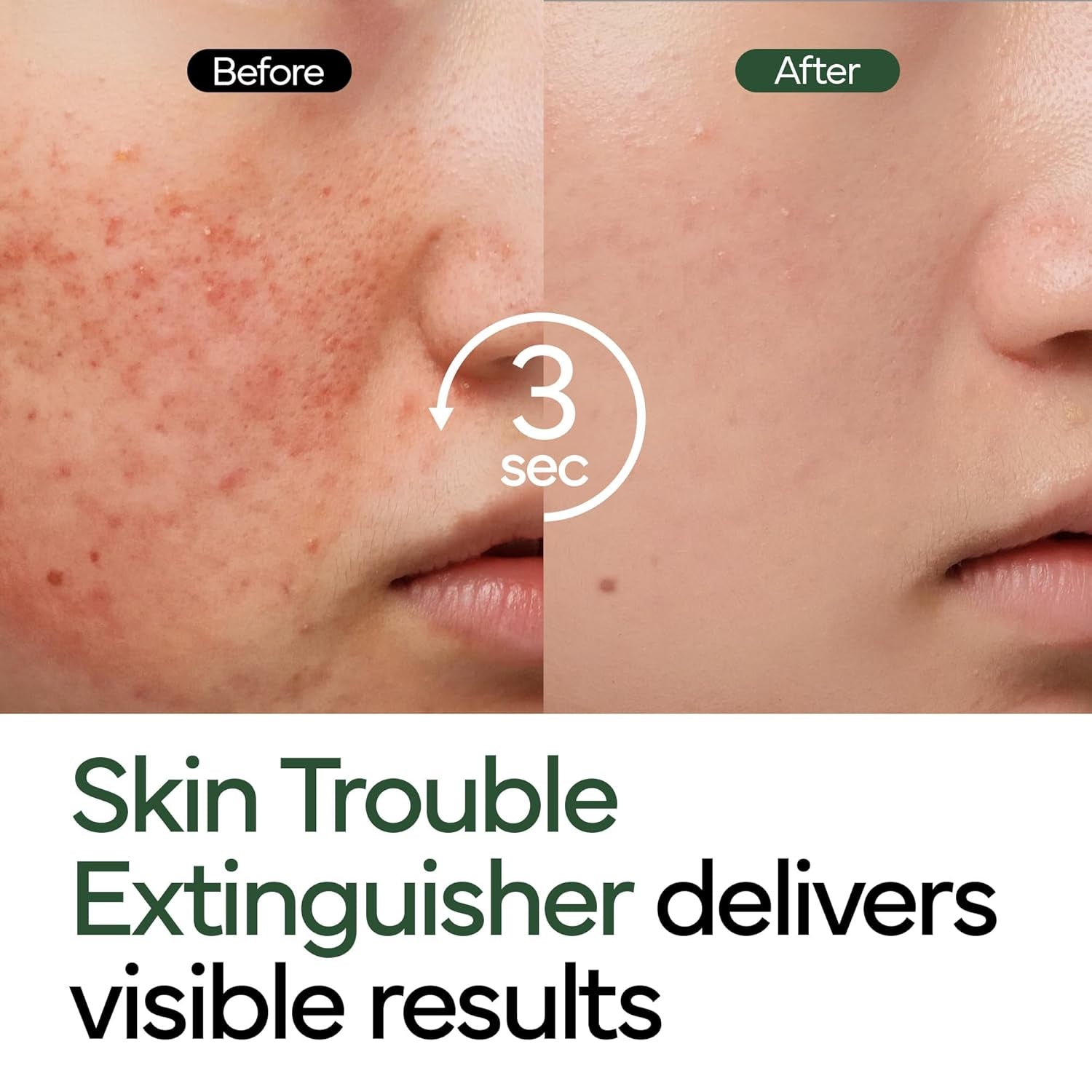 IVOSKIN Intensive Cica Repair Cream – 50g | Soothing Barrier Cream for Redness, Sensitivity & Acne Recovery