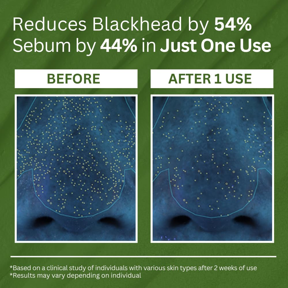 P.CALM Holy Basil BP.CALM Holy Basil Bubble Deep Mask – 90g | Blackhead & Pore-Cleansing Clay-to-Bubble Mask