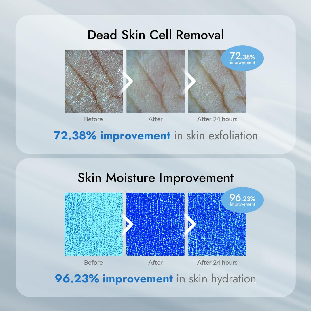 VILLAGE11FACTORY AHA 12% | Relax-day AHA Exfoliating Body Lotion – 300g