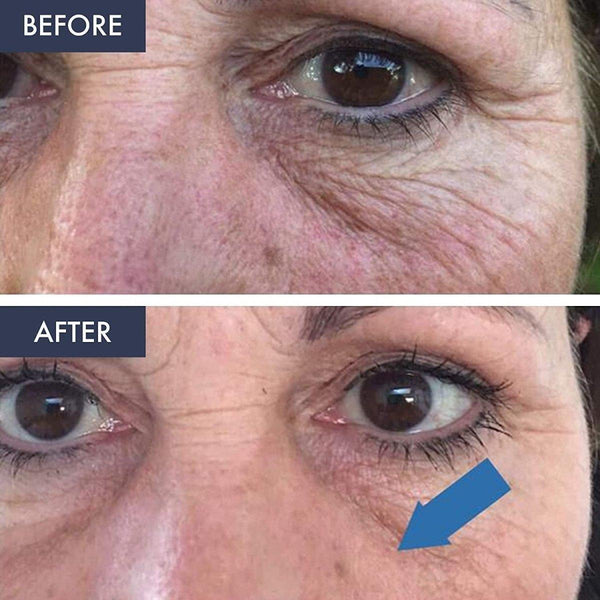 BioBare Vitamin C B E, and Ferulic Serum - 30ml - Glam Global UKBioBare