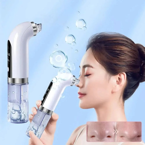 Blackhead Remover Device – Deep Cleansing and Hydration for Radiant Skin - Glam Global UKGlam Global UK