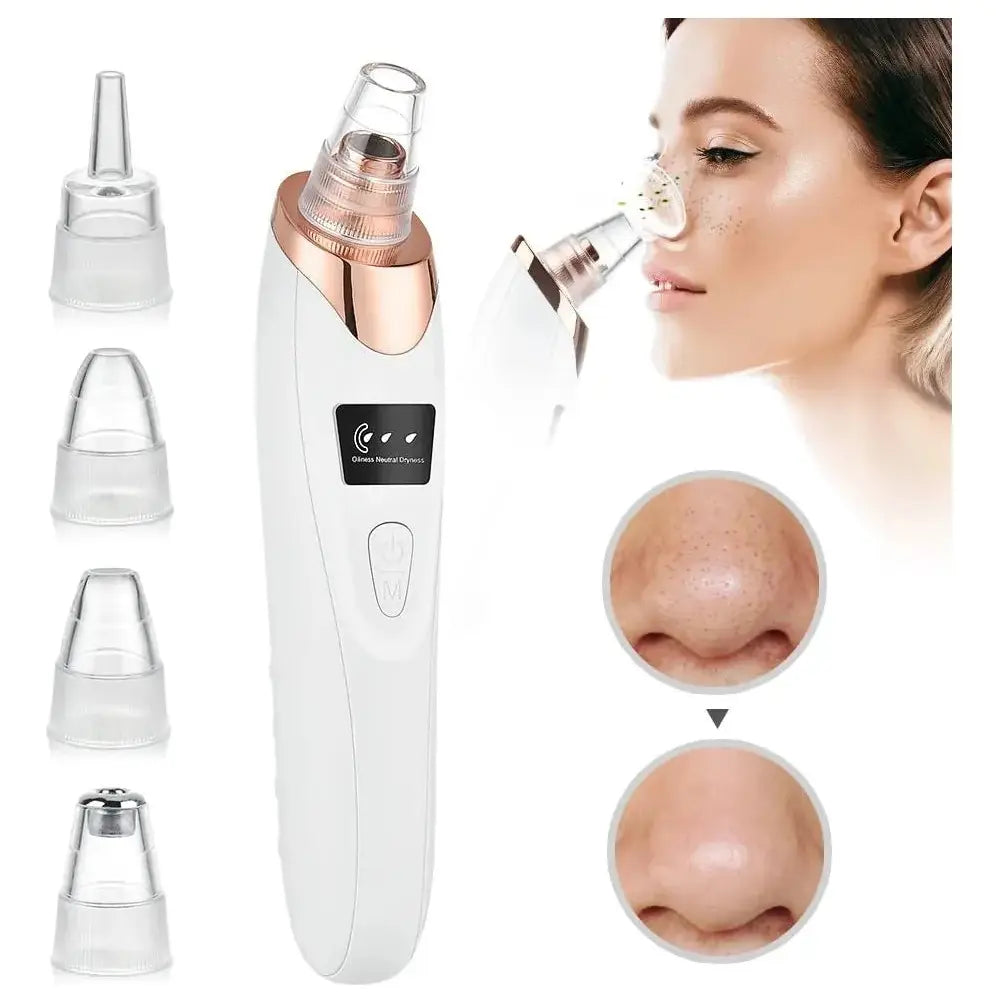 Blackhead Remover Vacuum – Acne, Pimple & Black Spot Treatment - Glam Global UK