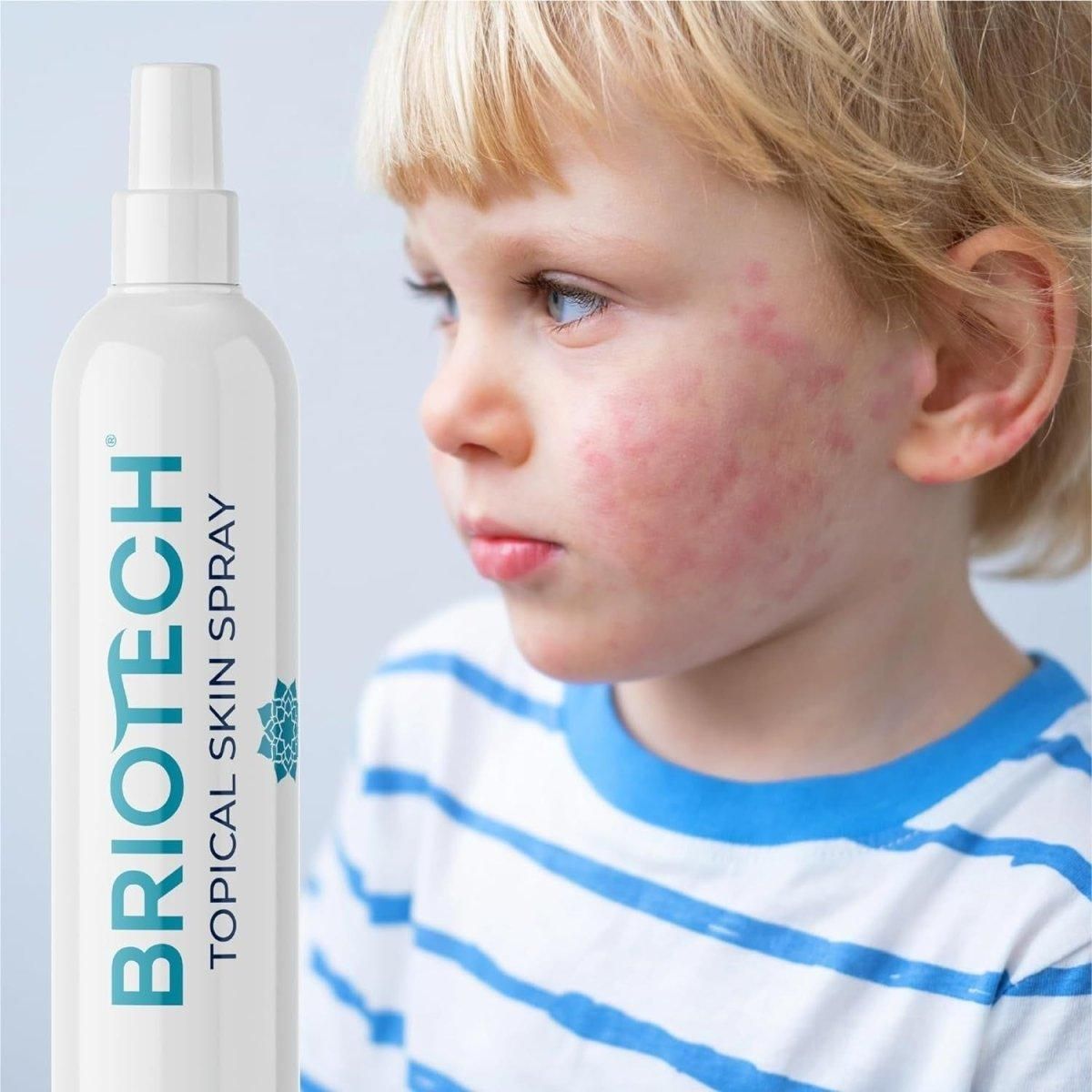 BRIOTECH Topical Hypochlorous Acid Spray - 240ml - Glam Global UK