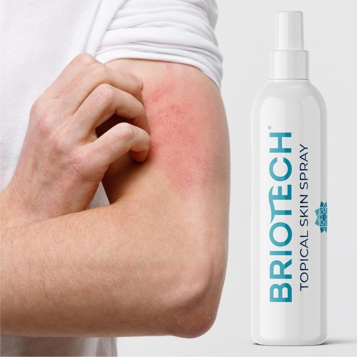 BRIOTECH Topical Hypochlorous Acid Spray - 240ml - Glam Global UK