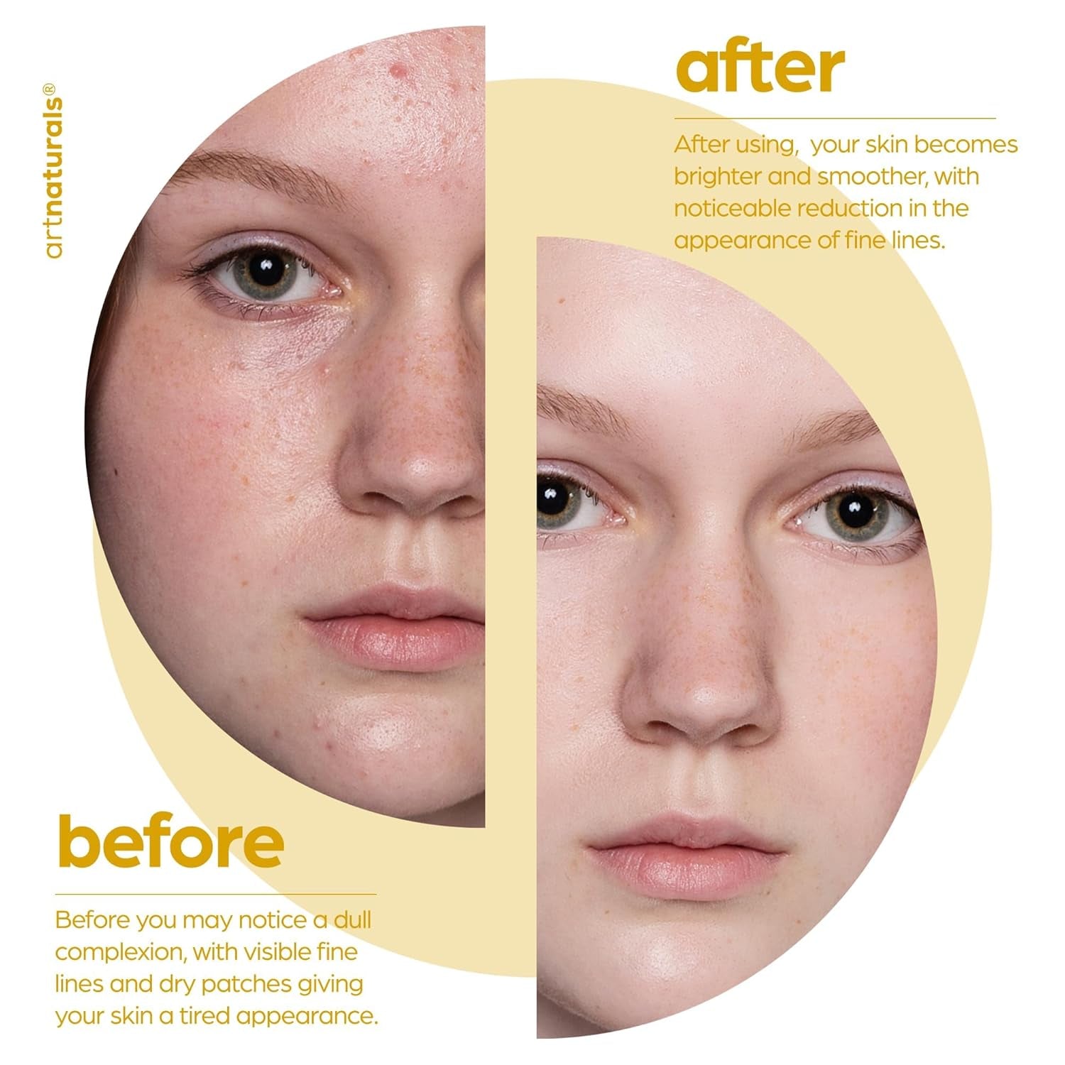 Artnaturals Lactic Acid + AHA Serum – 30ml | Brightening & Hydrating Exfoliant for Dry, Dull Skin