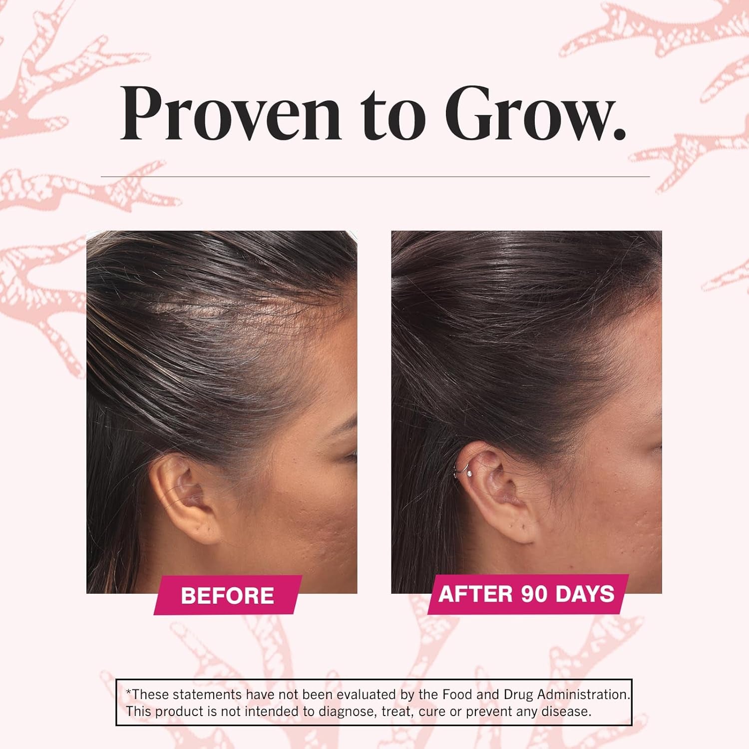 Hair Growth Supplements for Women for Thicker, Fuller Hair, Nourishes Thinning & Loss, with Proprietary Collagen Complex, 180 Tablets, 3 Month Supply