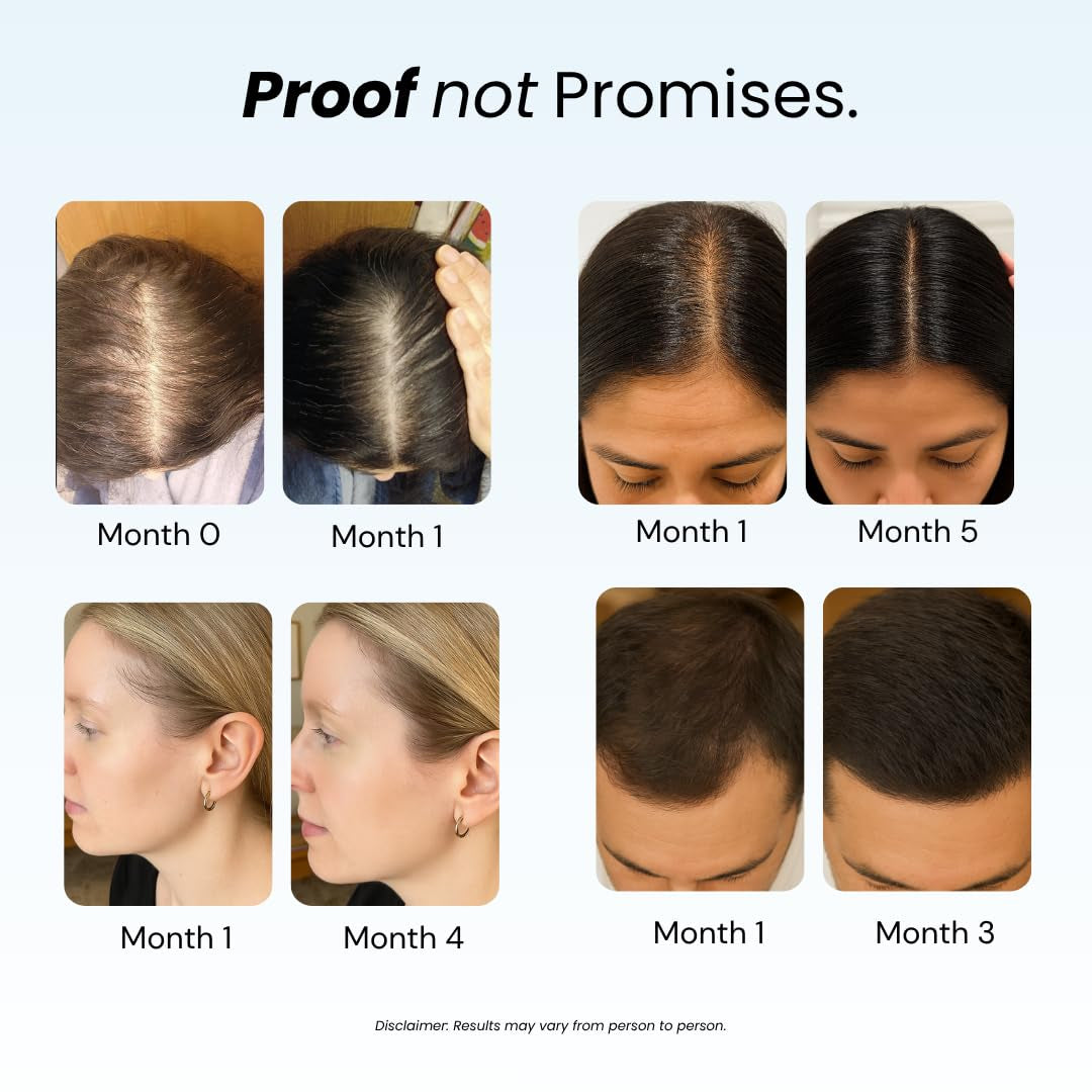 Revive Hair Strengthening Shampoo – with Biotin, Caffeine, Rosemary & Niacinamide – Supports Thicker, Fuller-Looking Hair – Sulfate-Free – 250Ml