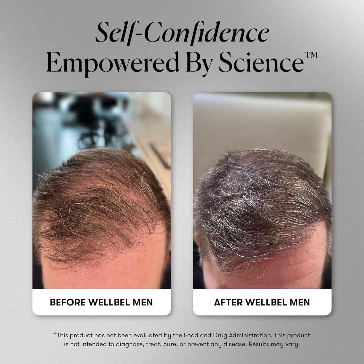 WELLBEL Men Clean Hair Supplement – 90 Capsules | Drug-Free Daily Formula to Support Hair Growth & Thickness