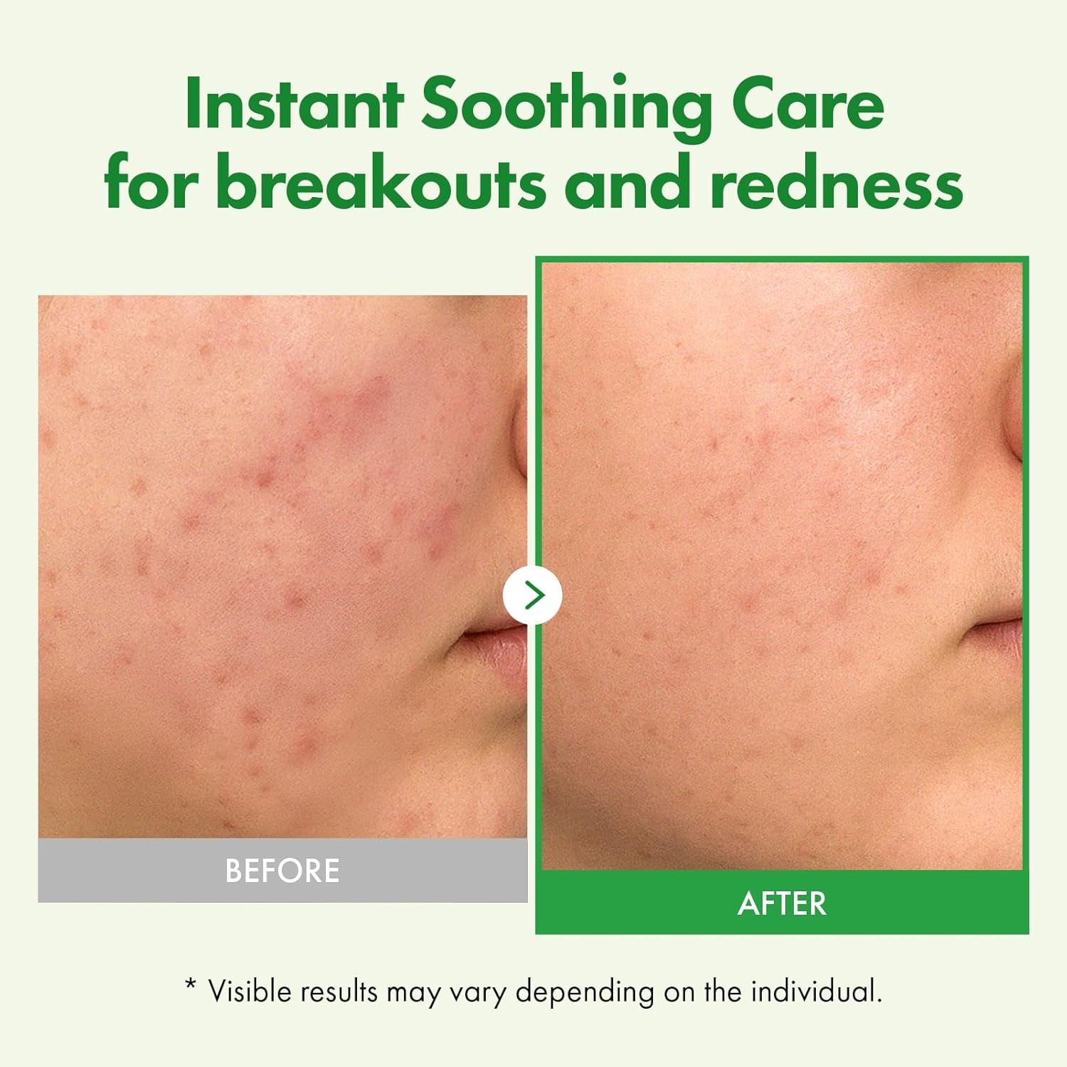 Madagascar Centella Cream, 706,580Ppm Madagascar Centella Asiatica, Moisturizer, Rapid Soothing, Deep Hydration with Cica Complex, Skin Barrier Repair, Irritation Relief, 50Ml / 1.69 Fl. Oz.