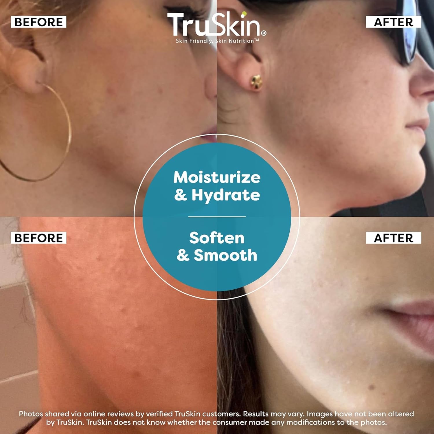 TruSkin HA Hyaluronic Acid Facial Serum – 30ml | Ultra-Hydrating, Anti-Aging Serum for Plump & Radiant Skin