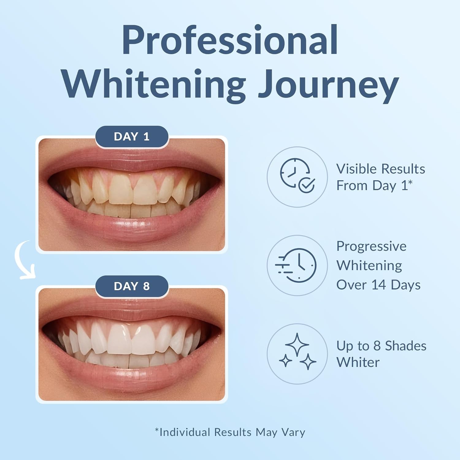 DR.DENT Professional Teeth Whitening Strips – 22 Treatments (44 Strips) | Advanced Whitening, Stain Removal & Enamel Protection