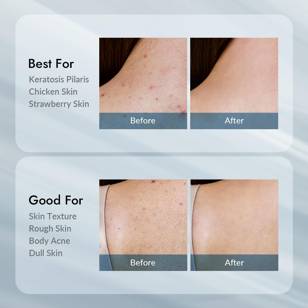 VILLAGE11FACTORY AHA 12% | Relax-day AHA Exfoliating Body Lotion – 300g