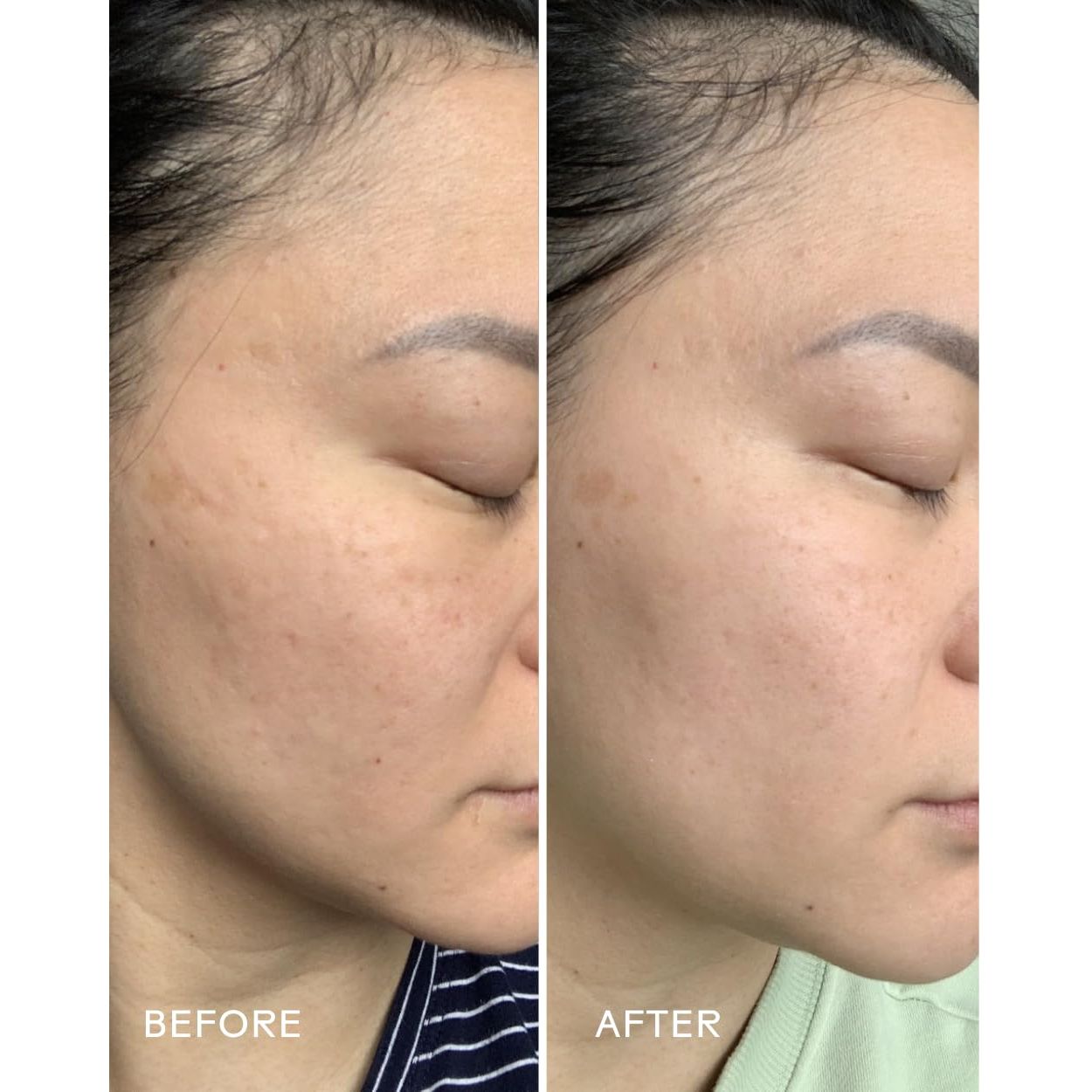 - Radiance Grape Stem Cell + Squalane Ultra-Hydrating Cream | Hydrate, Soften, Replenish Skin | Cruelty-Free, Vegan, Paraben-Free, Sensitive Skin Safe (1.76 Oz | 50 G)