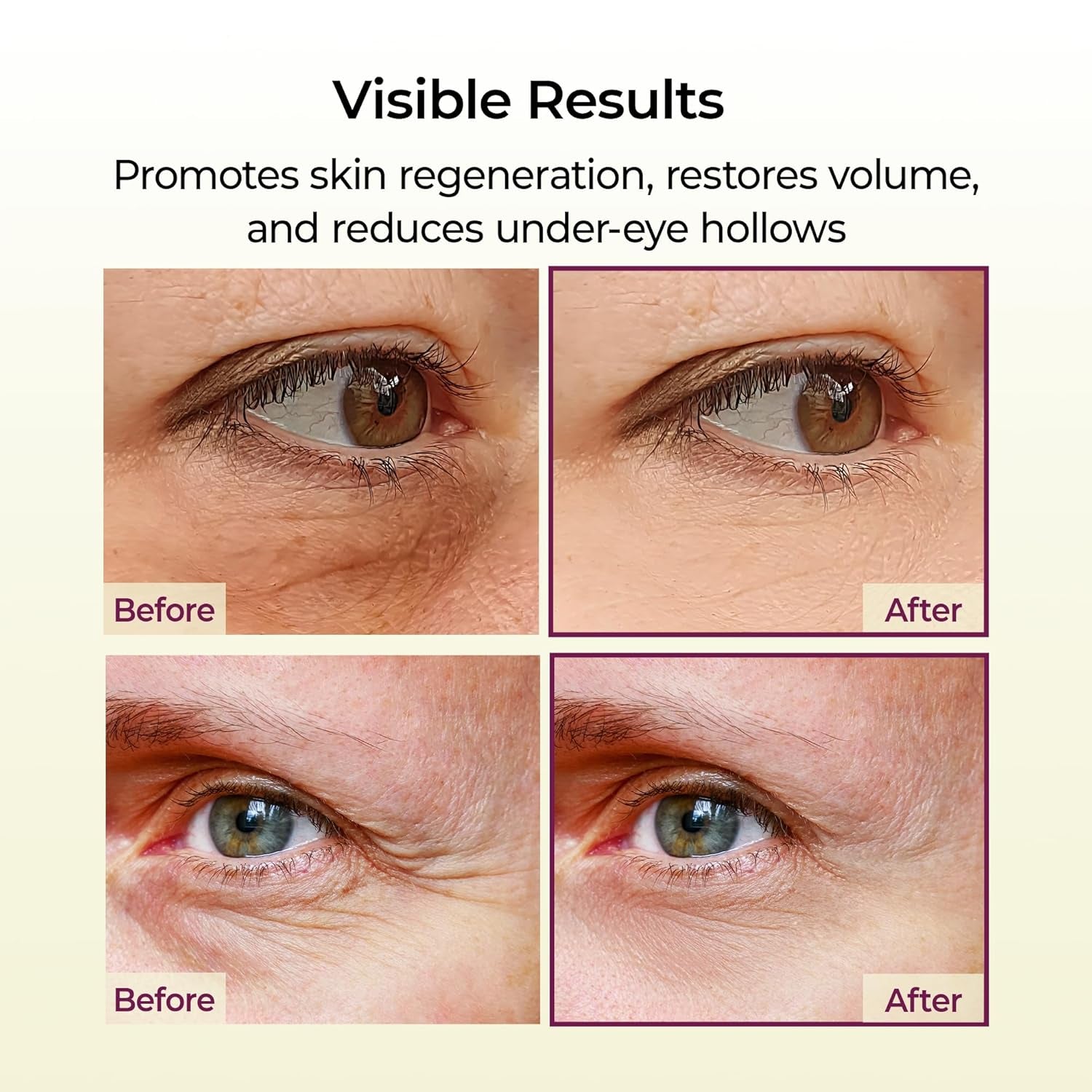 Cemenrete Calcium Multi Balm 9G Korean Skin Care All in One Calcium Volume Stick Collagen Wrinkles Face Eye Treatment Balm