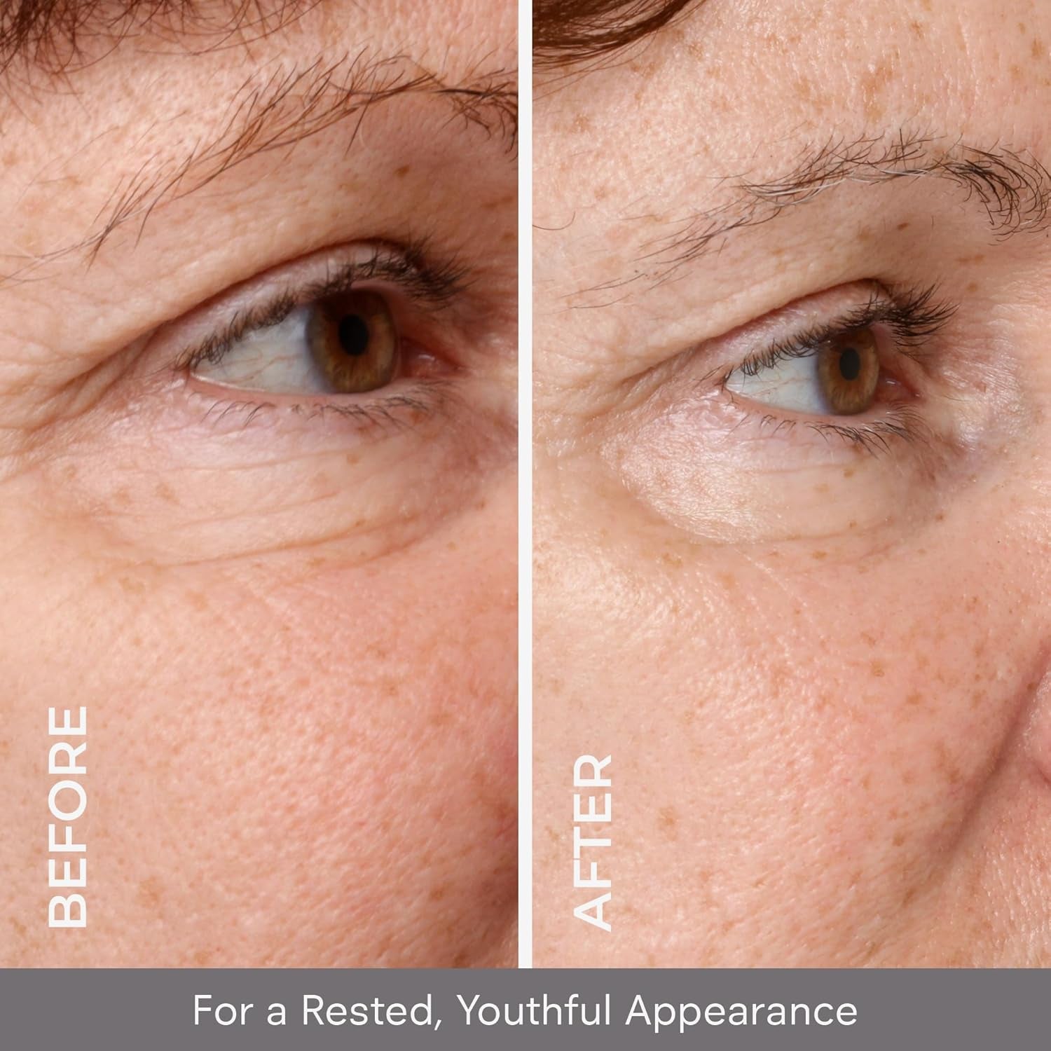 COSMEDIX Opti Crystal Liquid Crystal Eye Serum – 7g | Brightens, Firms & Reduces Dark Circles