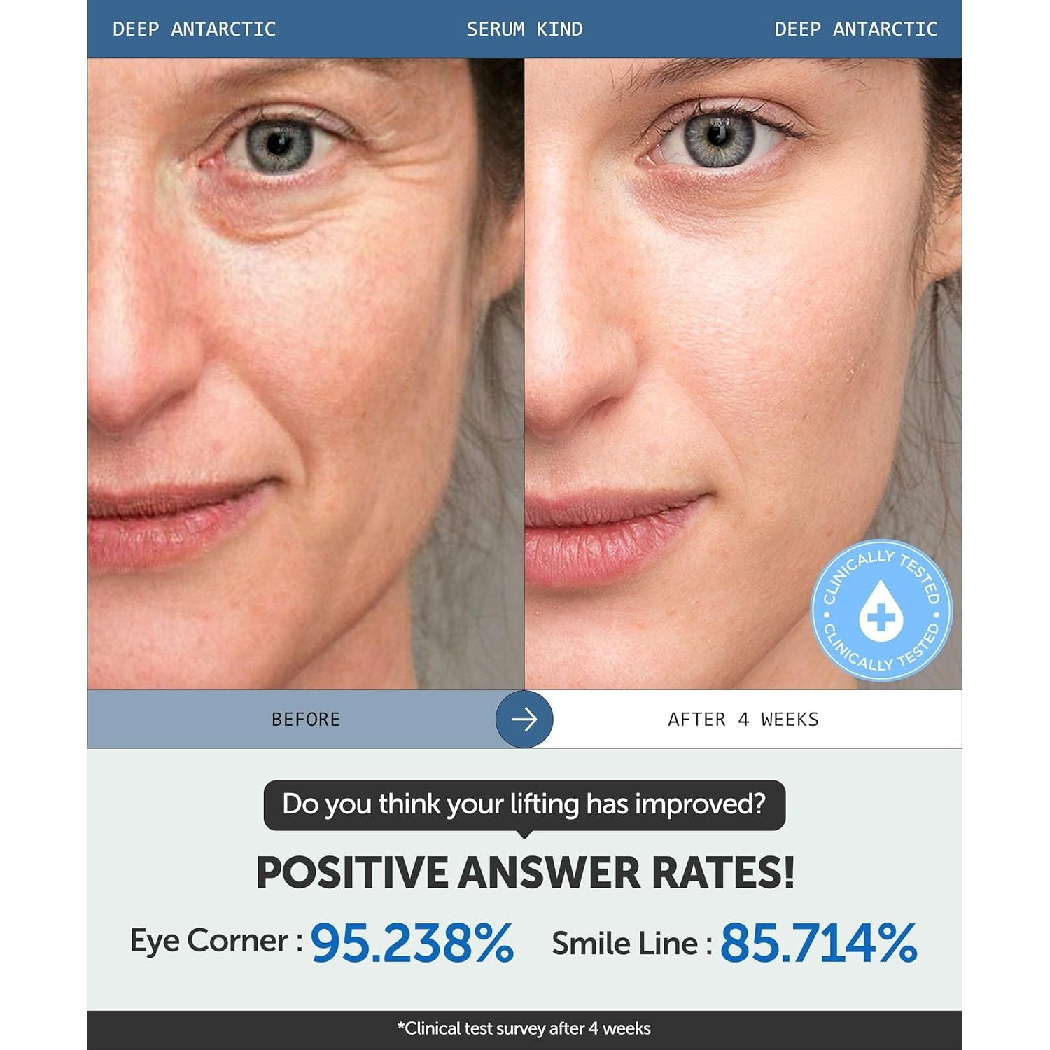 SERUMKIND Deep Antarctic Serum - Lifting, Plumping Korean Skincare – Antarcticine™ Marine Ingredient and Beta Glucan – Improves Elasticity and Firming - Vegan, Cruelty Free, Unscented – 1.01 Fl.Oz.