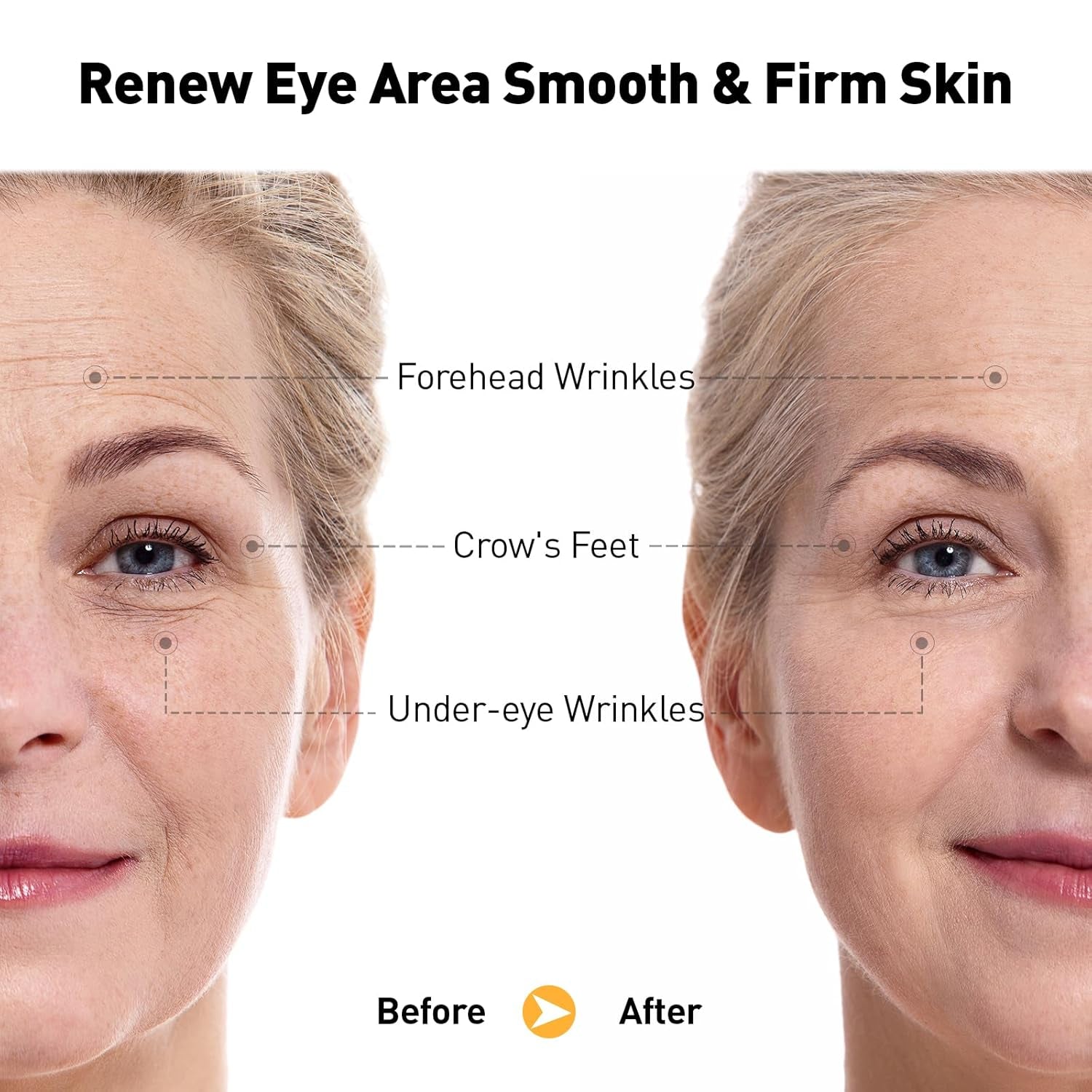 +1HEROLABS Retinol Eye Serum - 20ml