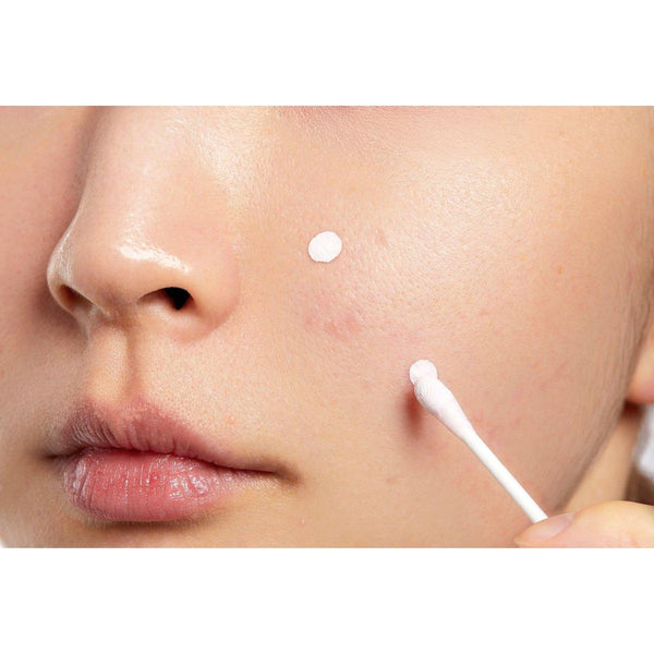 COSRX AC Collection Blemish Spot Drying Lotion 30ml - Glam Global UKCOSRX