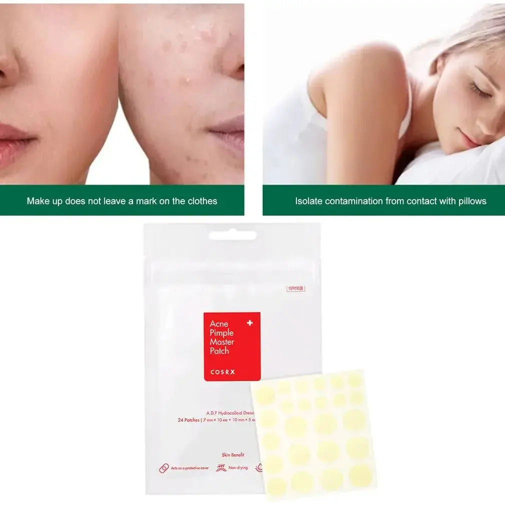 Cosrx Pimple Master Patch: Fast - Acting Spot Treatment for Clearer Skin - Glam Global UK