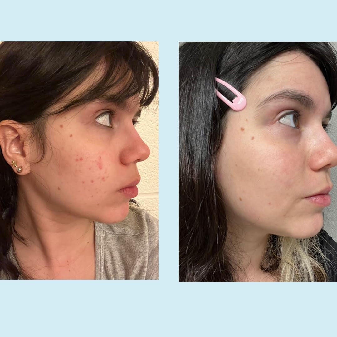 Perfect Image Glycolic 50% Gel Peel, Strength Level 2 (Age) - 30ml