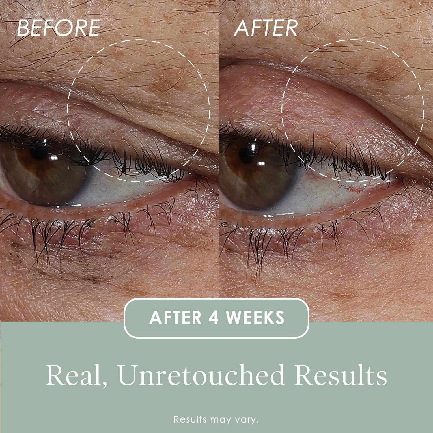 BODY FIRM Essentials Lift & Smooth Eyelid Treatment – 23ml | Firming, Lifting & Brightening Eye Solution