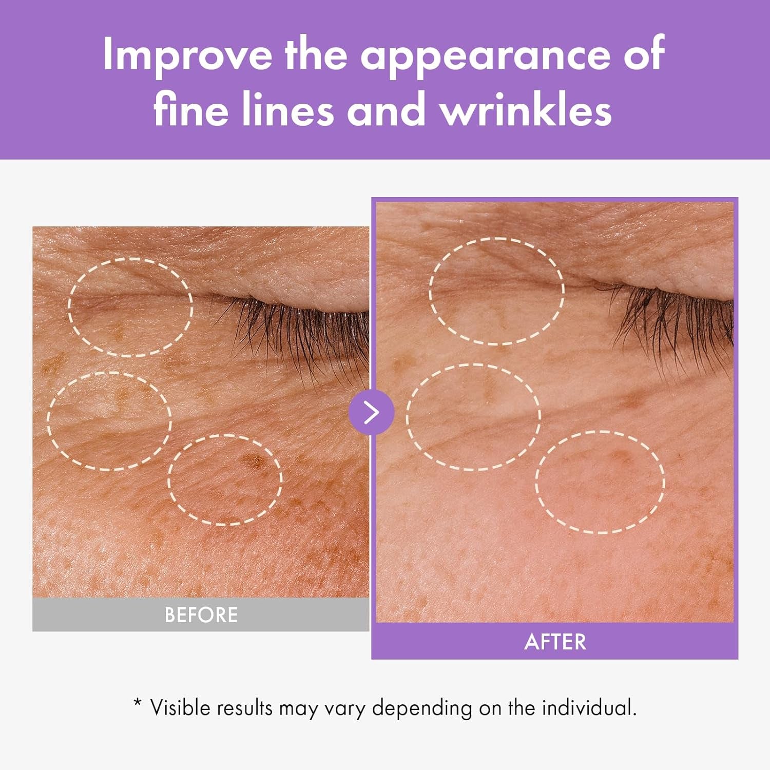 Bakuchiol Capsule Serum, 5,000Ppm Bakuchiol Retinol Natural Alternative, Anti-Aging, Plumping, Pore, Wrinkles, 8 Hyaluronic Acids, 5 Ceramides, Hydration, Korean Skincare, 33Ml/1.11 Fl.Oz.