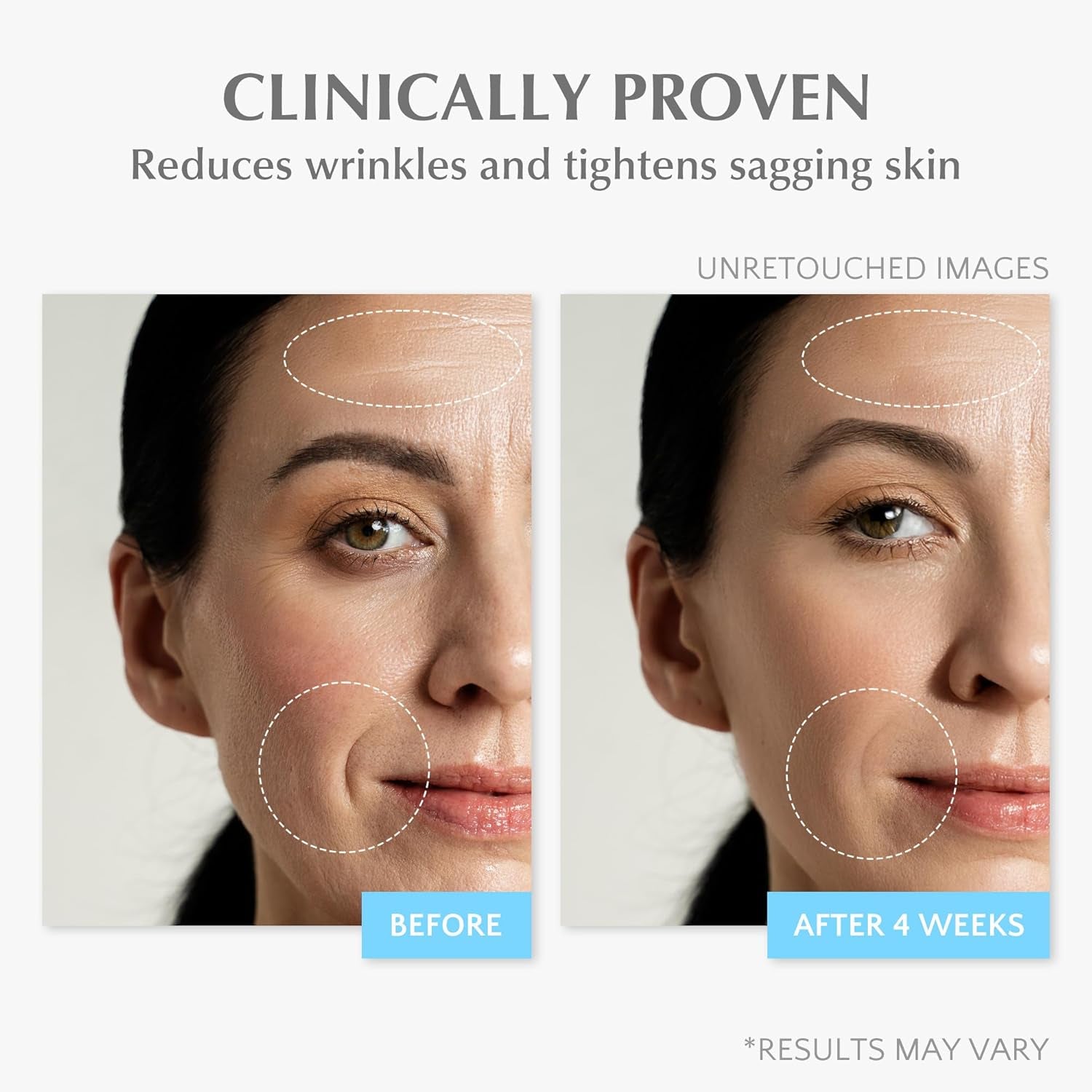 EnaSkin Retinol Collagen Face Cream – 50ml | Anti-Aging, Wrinkle Repair & Deep Hydration