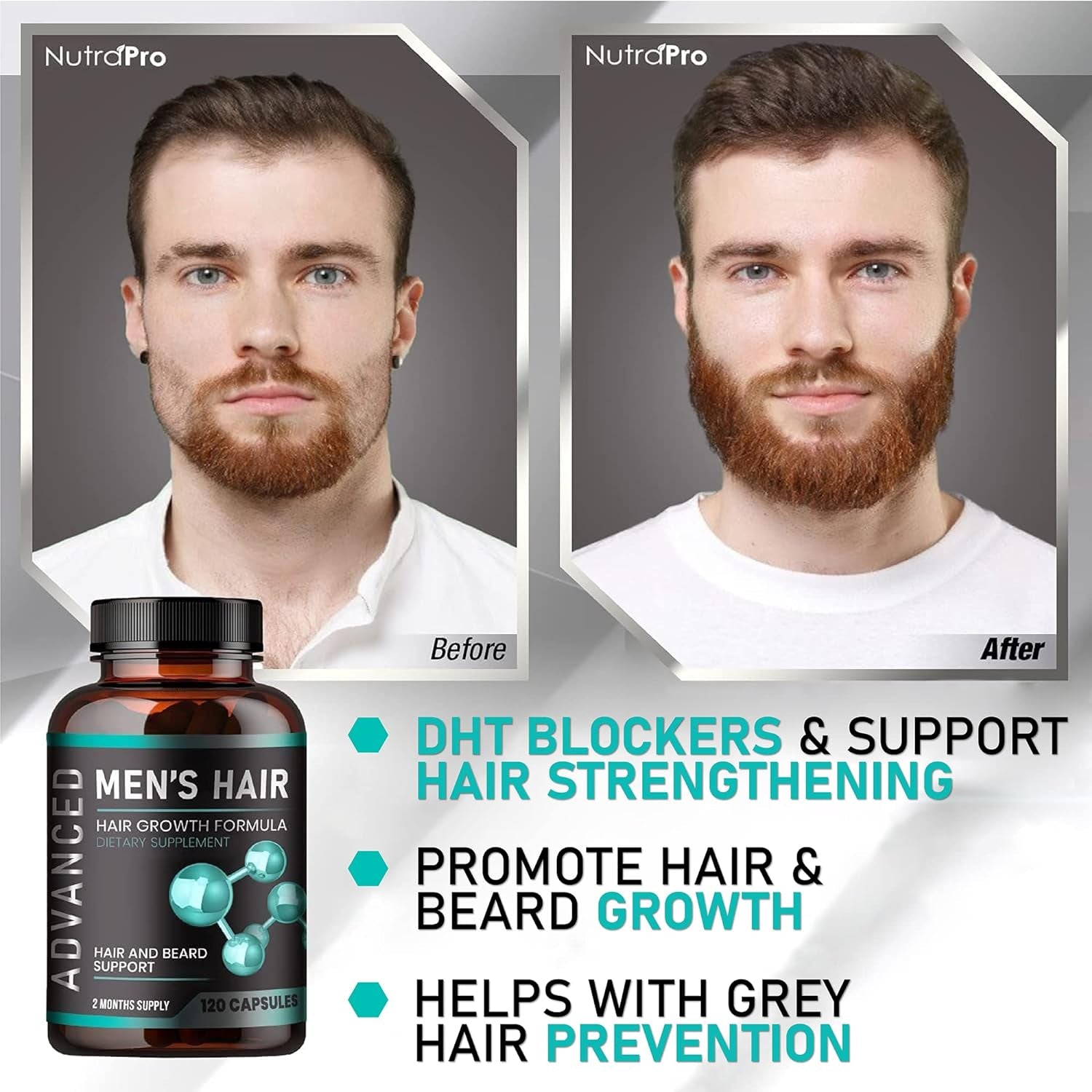 NutraPro Advanced Men’s Hair Growth – 120 Capsules | DHT Blocker & Biotin Supplement for Thicker Hair