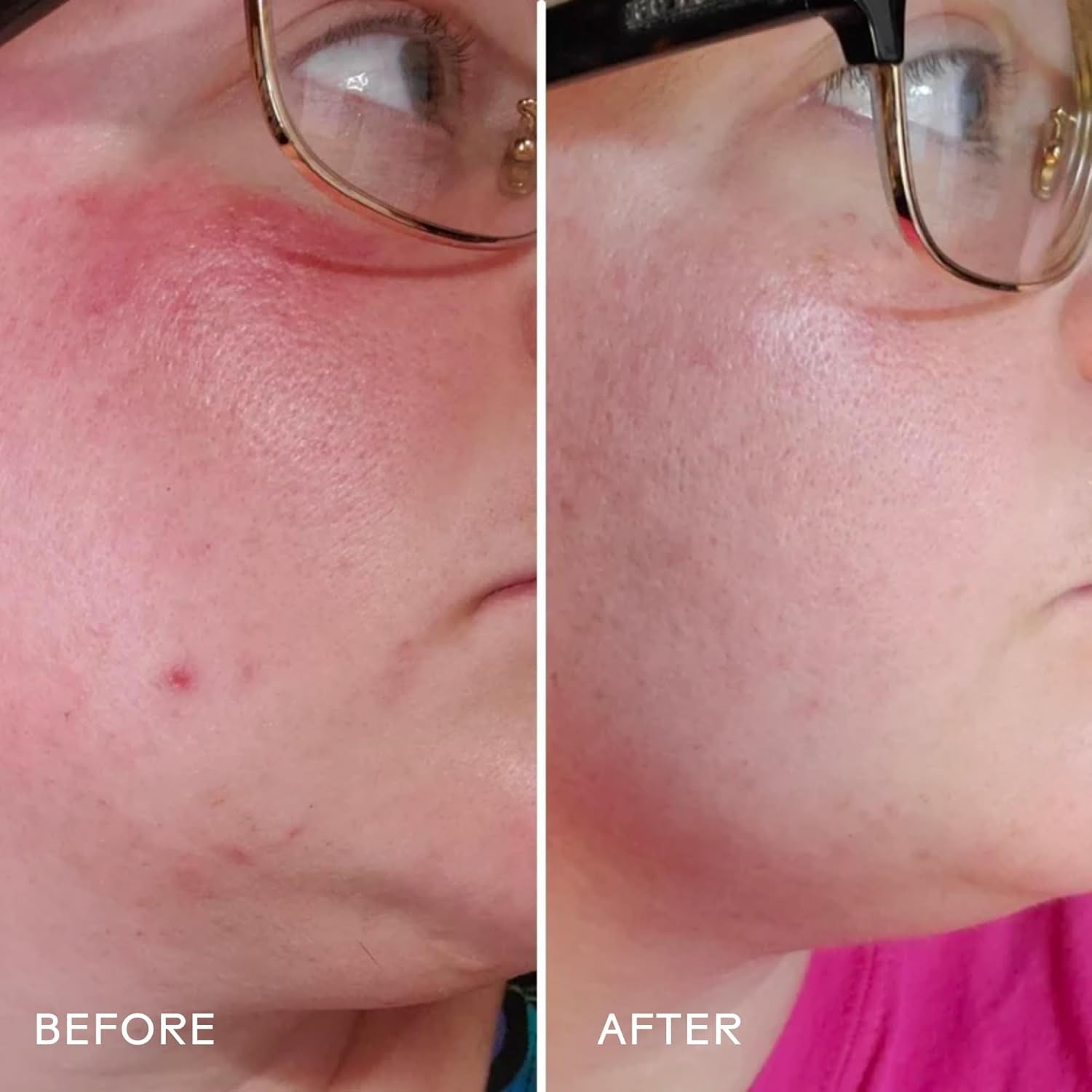 - Radiance Grape Stem Cell + Squalane Ultra-Hydrating Cream | Hydrate, Soften, Replenish Skin | Cruelty-Free, Vegan, Paraben-Free, Sensitive Skin Safe (1.76 Oz | 50 G)