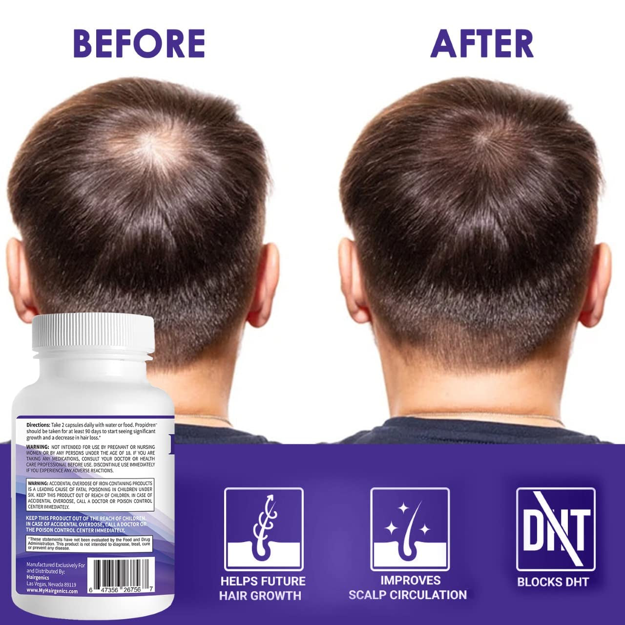 Pronexa Propidren – 512mg - 60 Capsules | DHT Blocker with Saw Palmetto, Biotin & Herbal Complex for Hair Loss Prevention