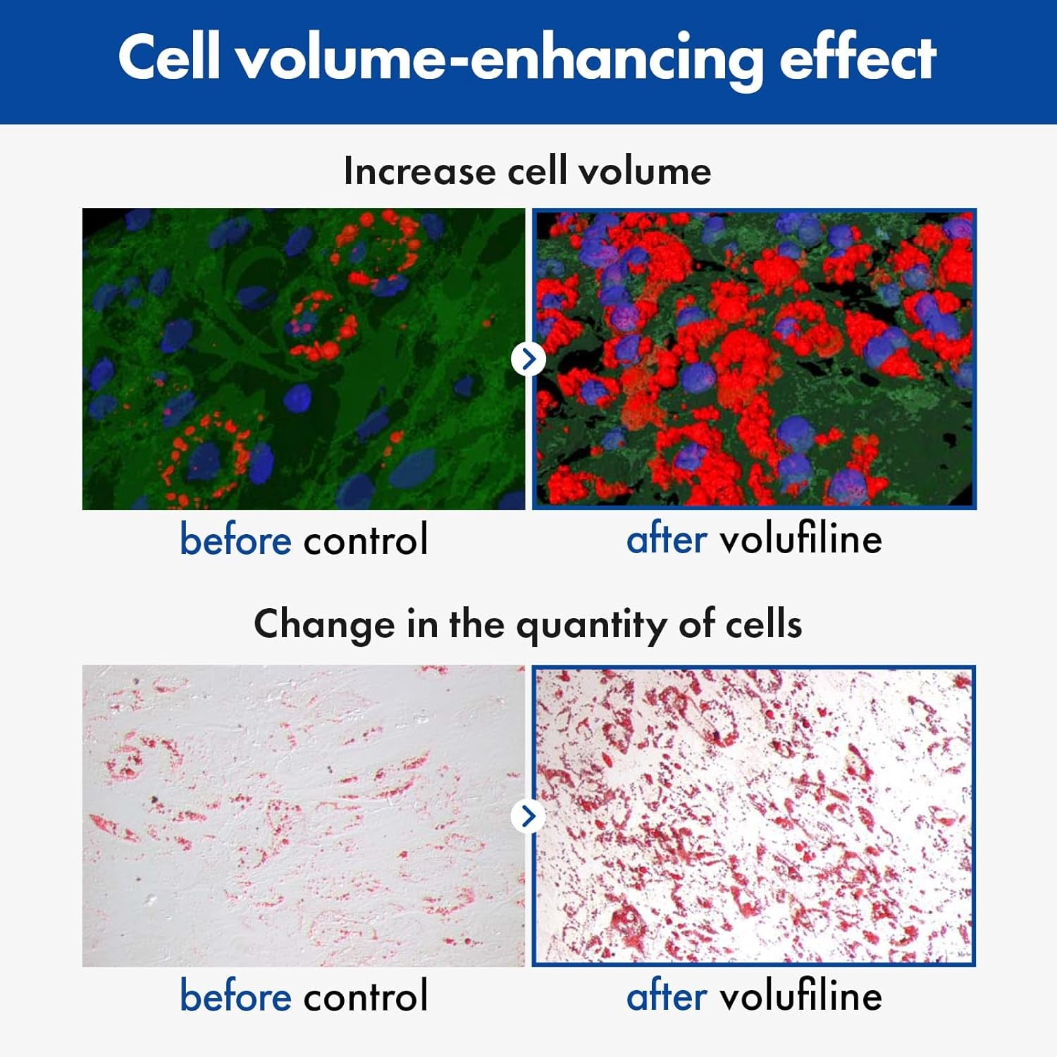 Volufiline Serum, 100% France Sederma Volufiline Concentrate for Plumping, Skin Firming, Boost and Glass Skin, Glow Skincare for Face, Lip and Body, 11Ml 0.37 Fl. Oz.