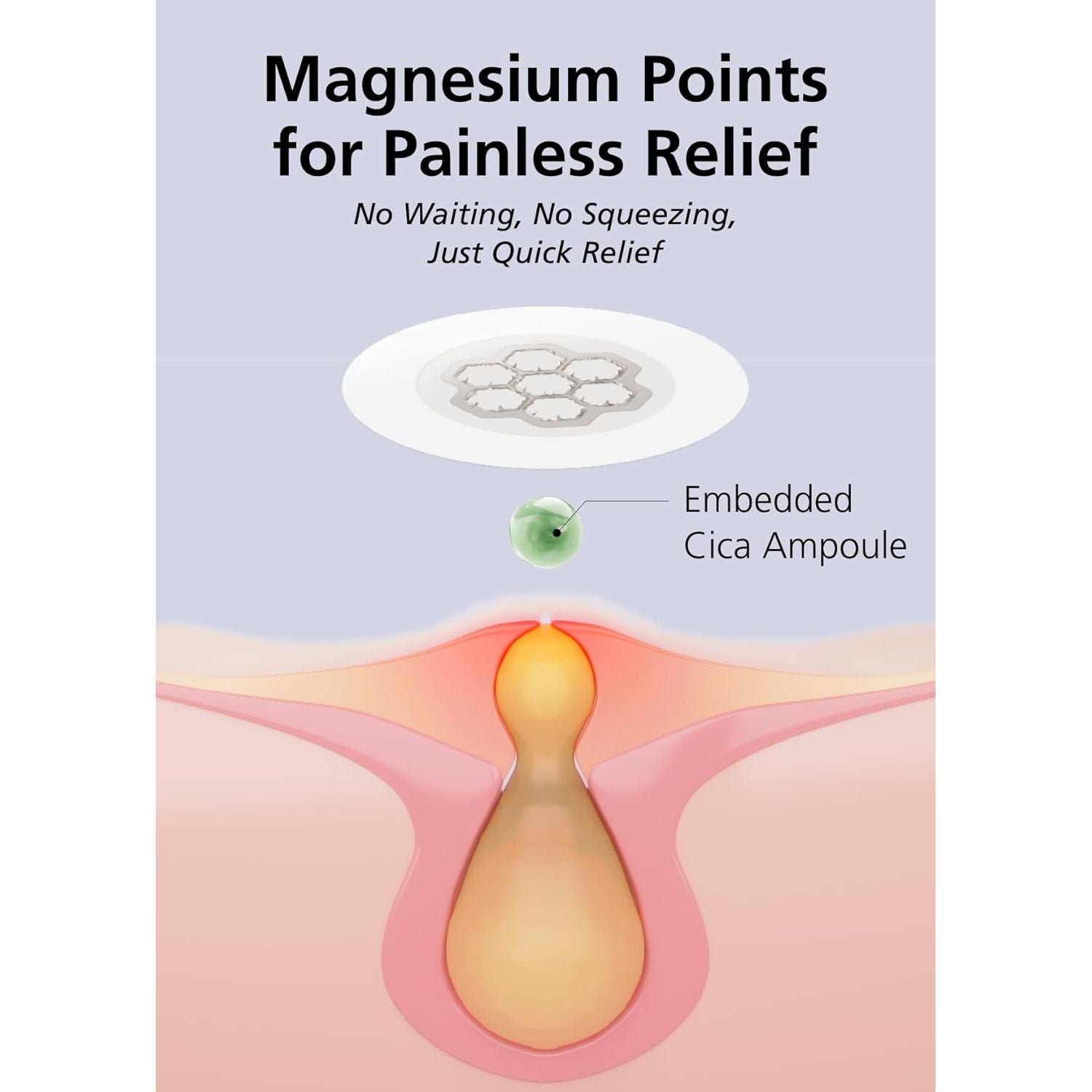 DWEasyDerm Quick Calming Magnesium Patches – 30 Patches (Bulk Pack) | Korean Acne Spot Treatment with Free CICA Ampoule