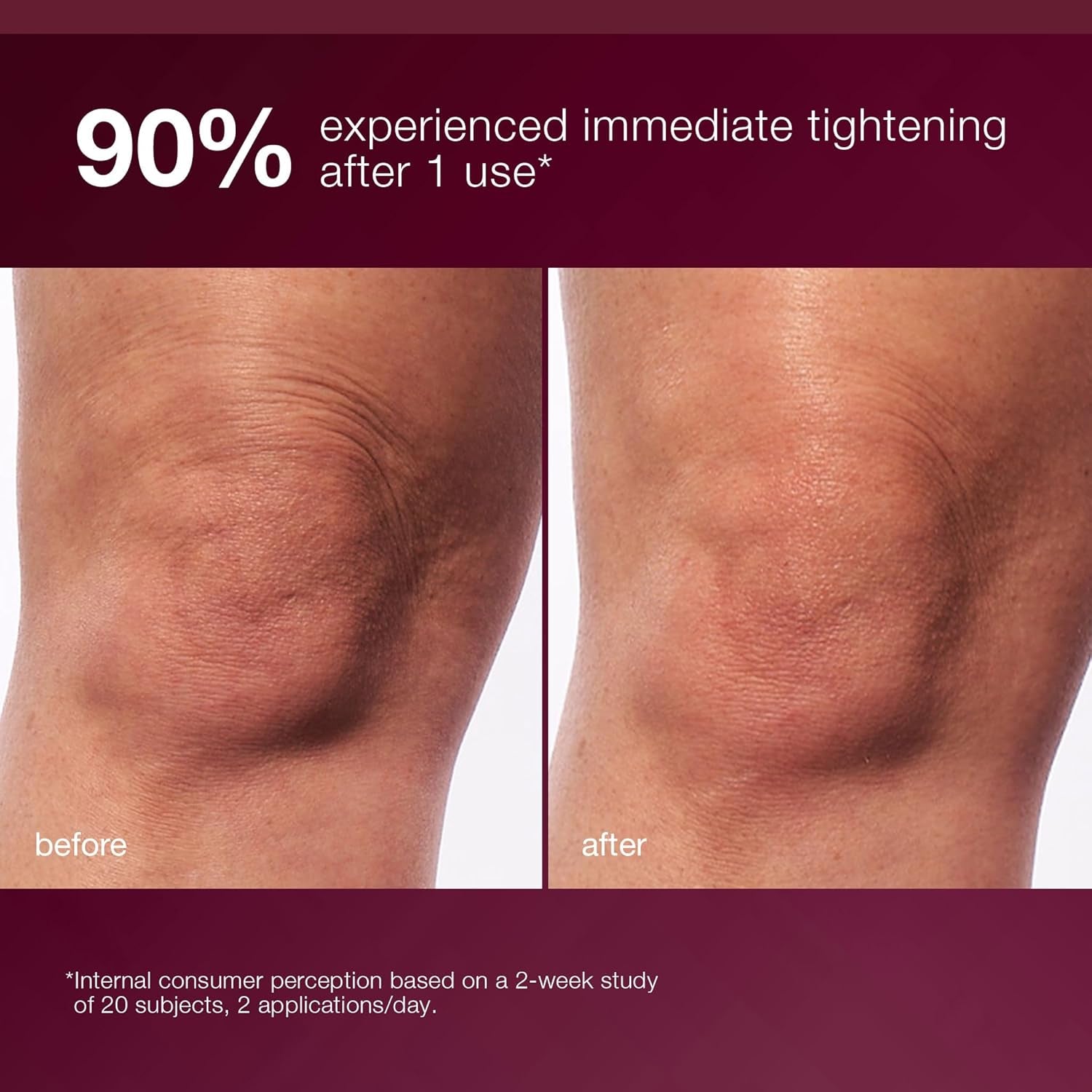 Dynamic Skin Sculptor Body Serum, Firimg and Hydrating Body Sculping Lotion - Tightens, Tones, and Sculpts Skin, 5.1 Fl Oz