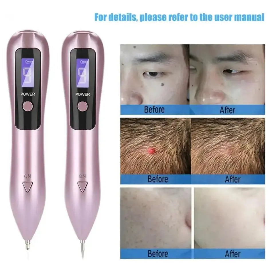 Dark Spot & Tattoo Remover Pen - Glam Global UK