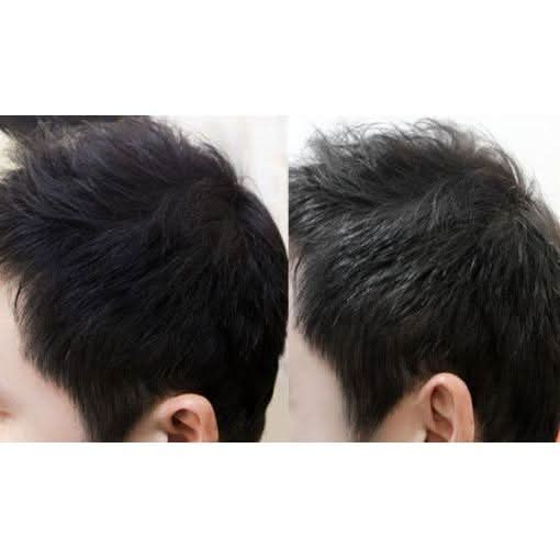 DASHU Daily Anti - Hair Loss Fixer Mist 120ml - Glam Global UKDASHU