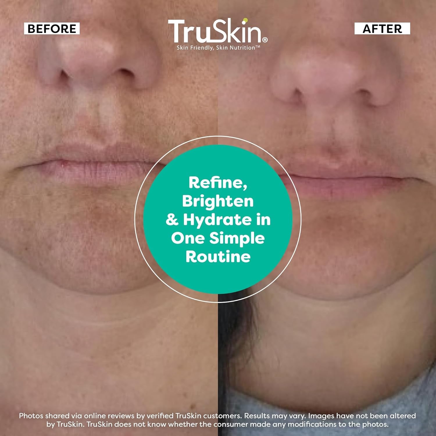 TruSkin Face Serum Trio – 30ml (3 Bottles) | Brightening, Anti-Ageing & Hydrating Skincare Set
