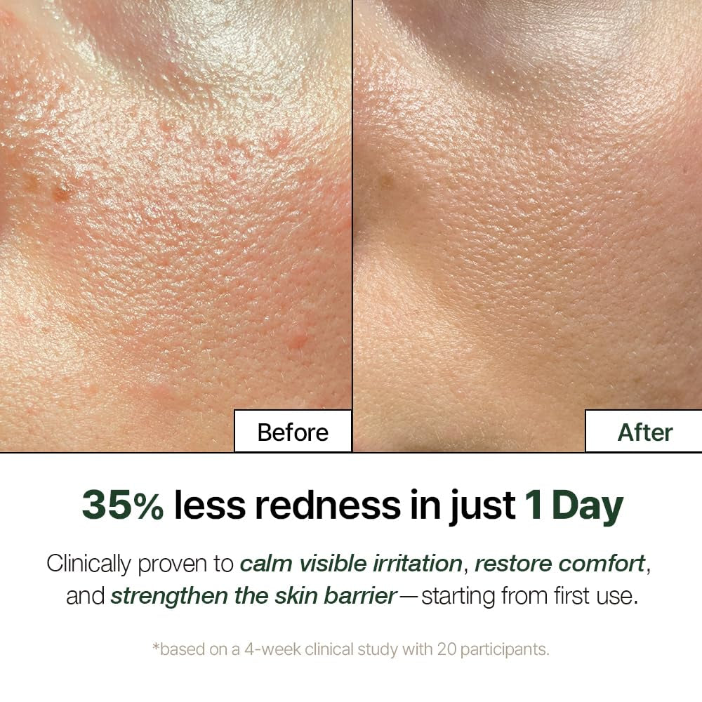 NDP Cica Cream - Gel Face Moisturizer for Sunburn Relief, Lightweight Korean Moisturizer for Sensitive Skin, Centella Asiatica, Hydrating, Calming, Soothing (1.7 Fl Oz / 50Ml)