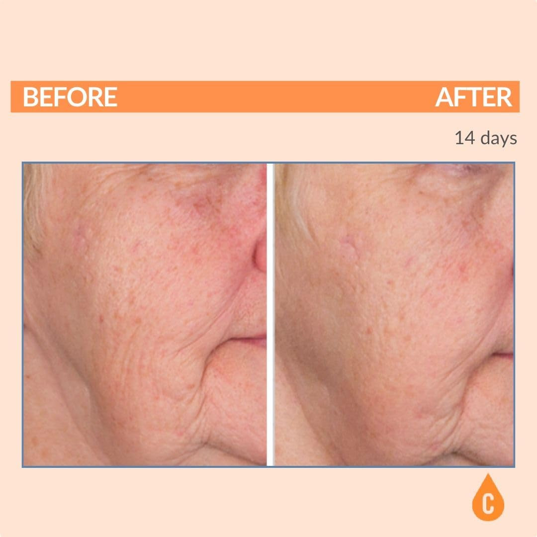 Serious Skincare Serious-C3 Plasma™ Bio Technology C Serum – 30ml | Brightening, Hydrating & Anti-Aging Treatment