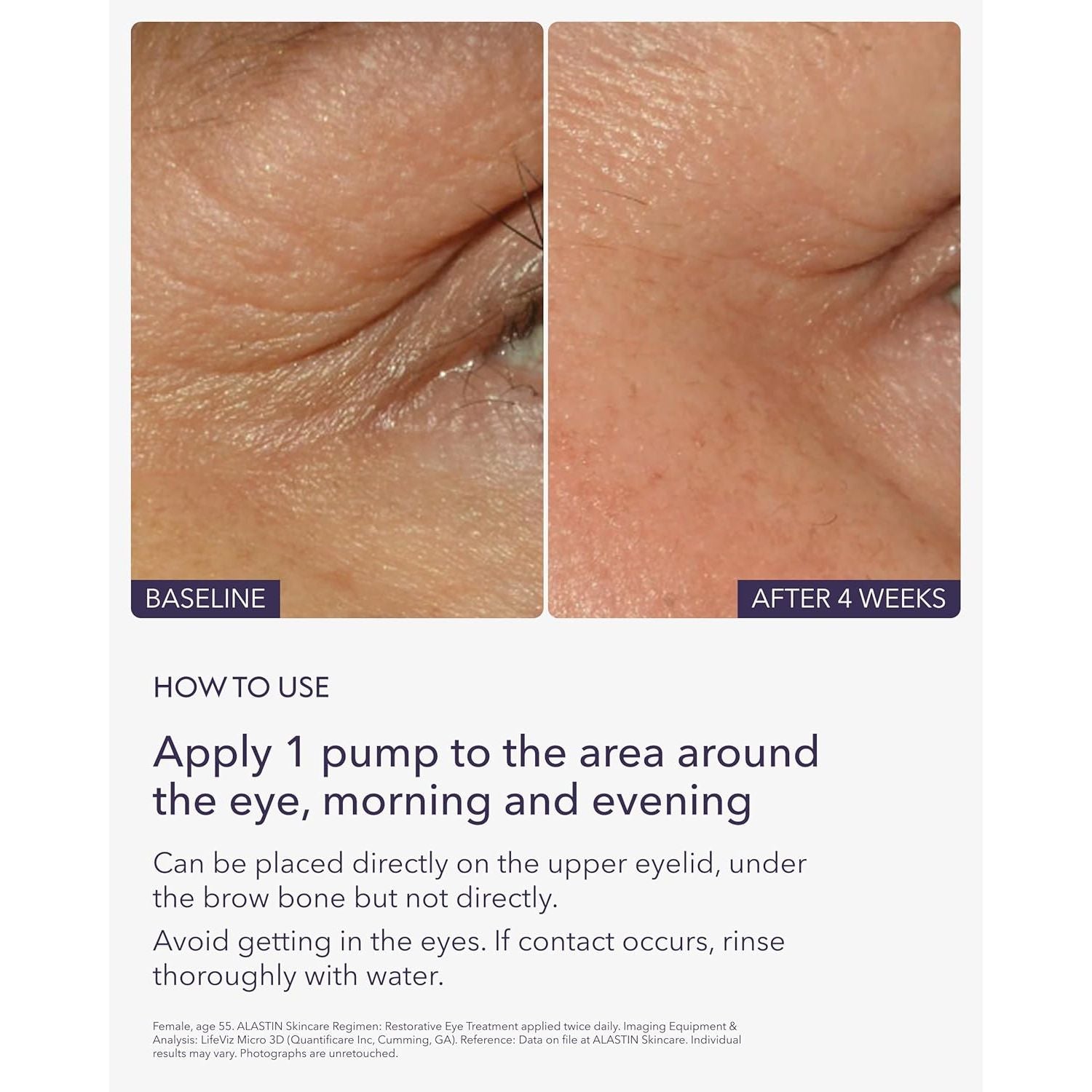 Restorative Eye Complex (0.5 Oz) | Anti-Aging Eye Cream | Helps Visibly Smooth & Hydrate | Reduces the Look of Puffiness & Dark Circles