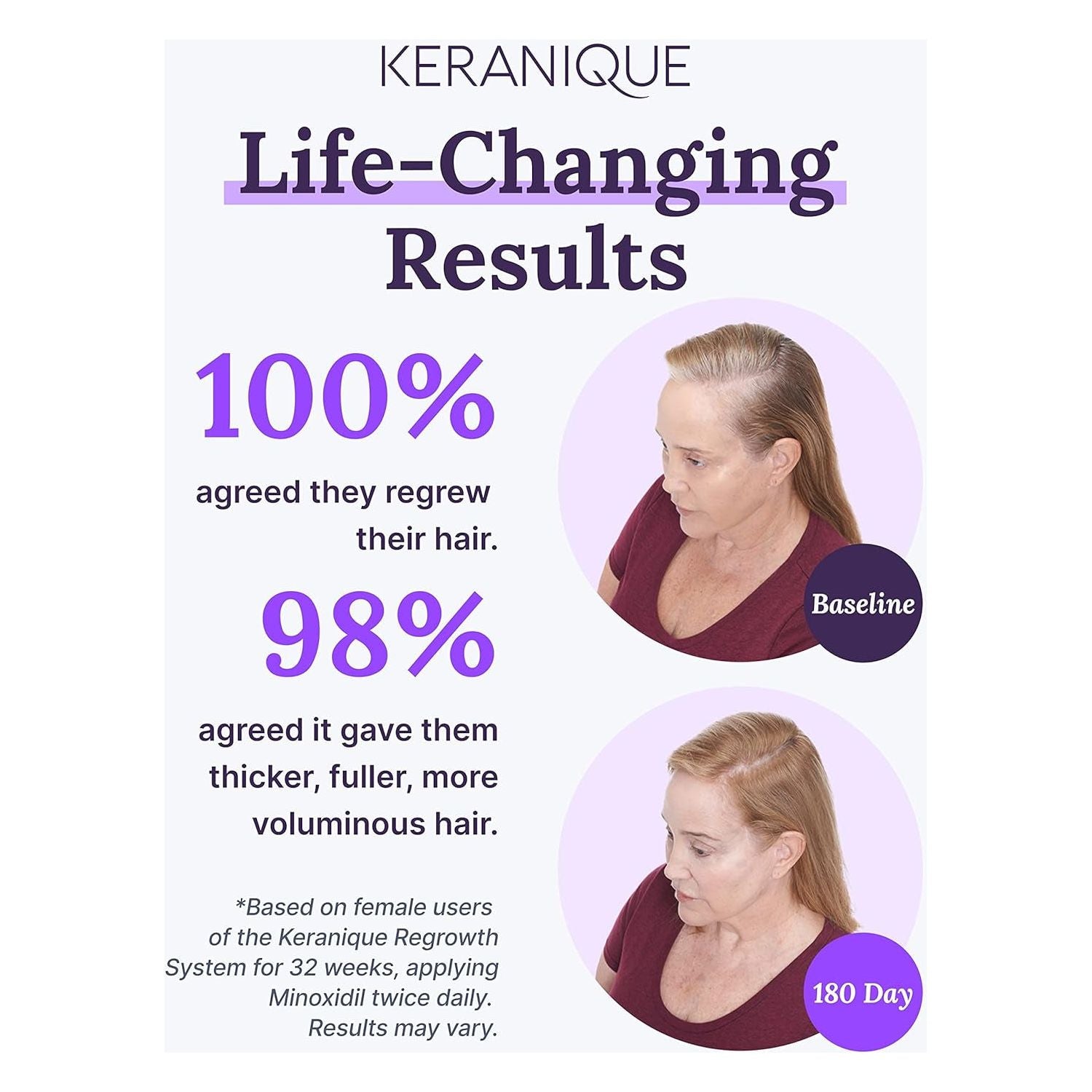 Keranique Women’s 2% Minoxidil Topical Solution – 60ml | Clinically Proven Hair Regrowth Treatment for Thicker, Fuller Hair