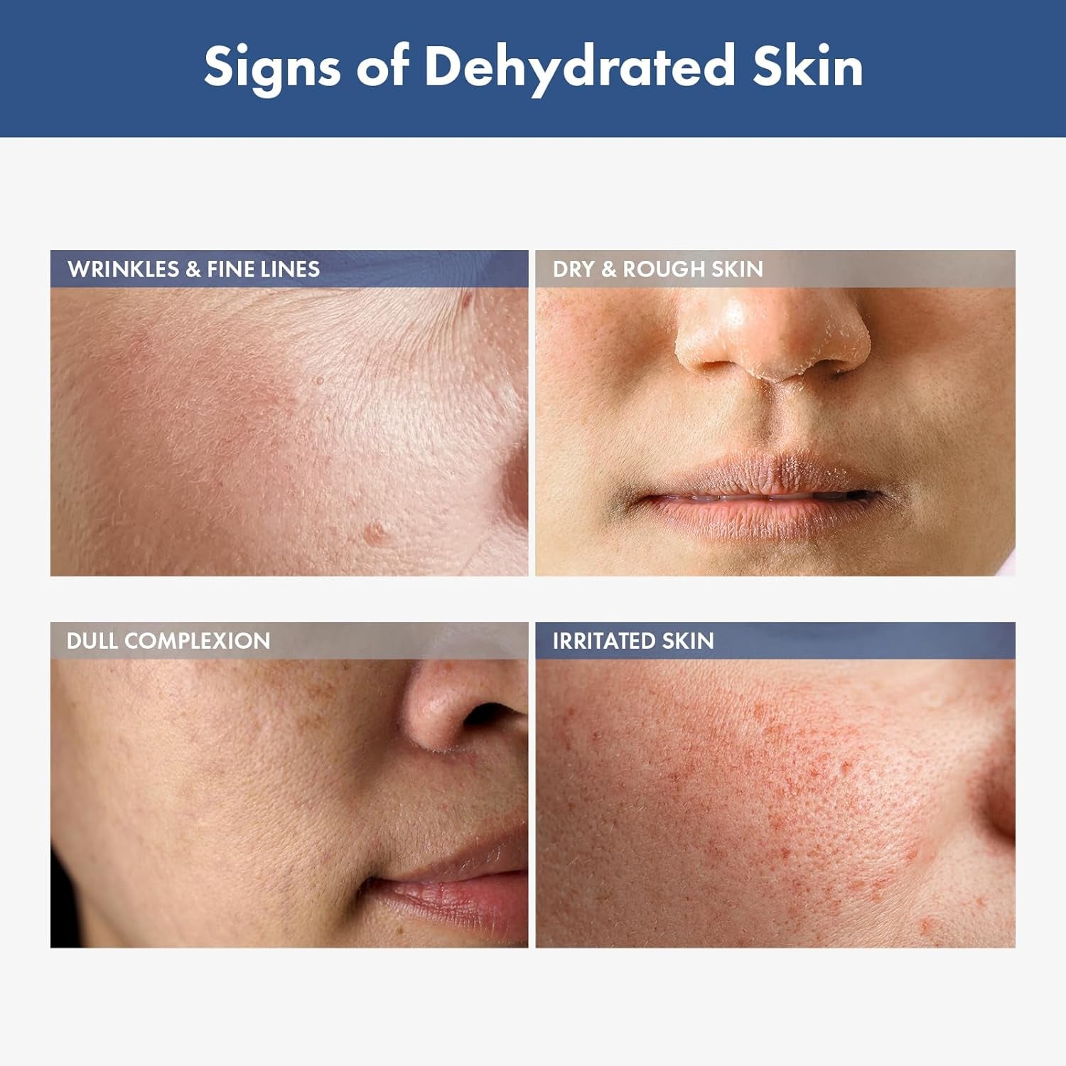 Hyaluronic Acid 3% Serum, 30,030Ppm Sodium Hyaluronic Acid, Hydration, Moisture Boosting Facial Serum for Fine Lines & Wrinkles, Plump & Repair Dry Skin, Korean Skin Care, 30Ml, 1.01 Fl.Oz.