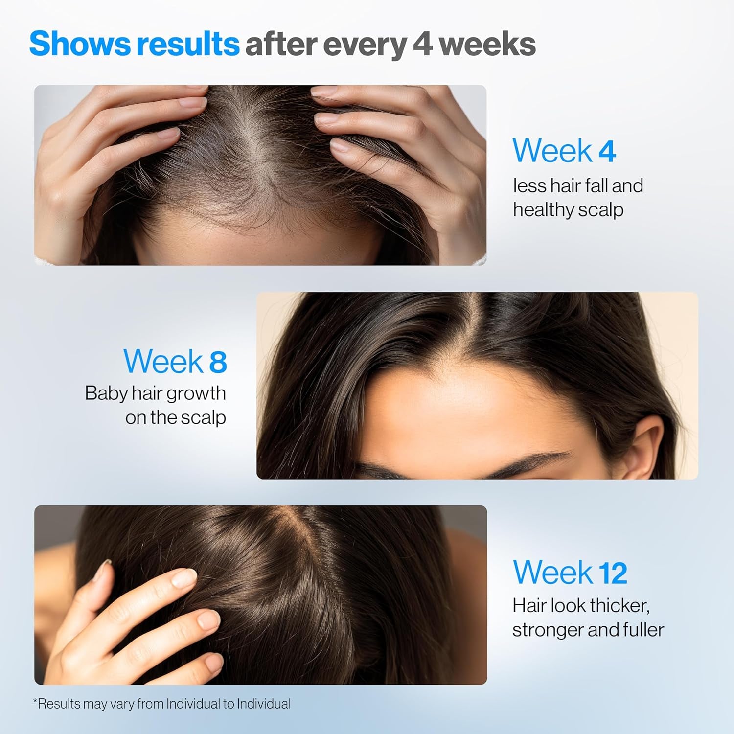 Rosemary Hair Growth Serum Roll on 50 Ml – 3% Rosemary, 3% Redensyl & 2% Anagain | Dht-Blocking Scalp Serum Boosts Oxygen Flow, Reduces Hair Fall | Paraben/Sulfate-Free | Women & Men