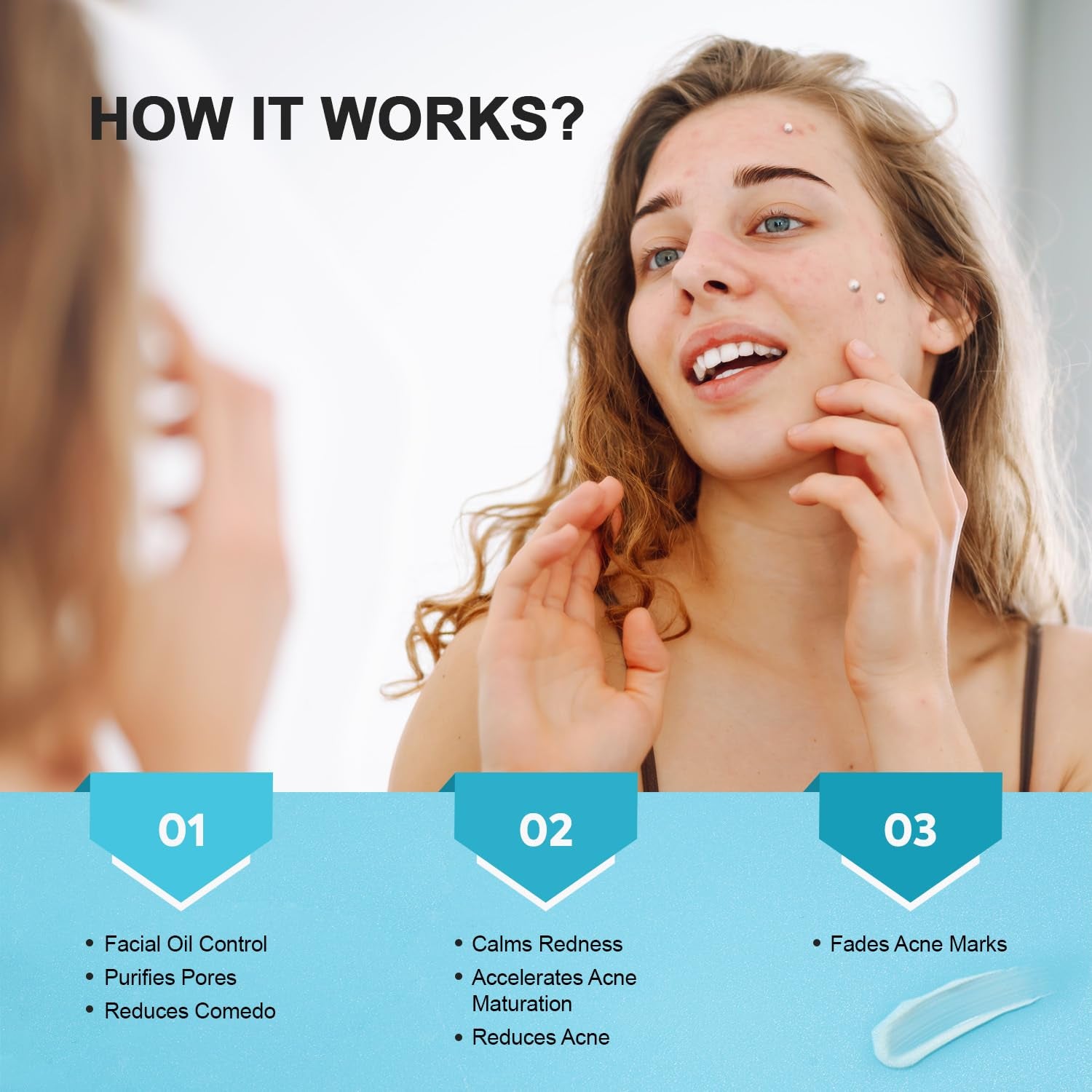 Enaskin Naturals 10% Azelaic Acid Acne Treatment – 50g | Advanced Acne & Scar Defense Gel-Cream