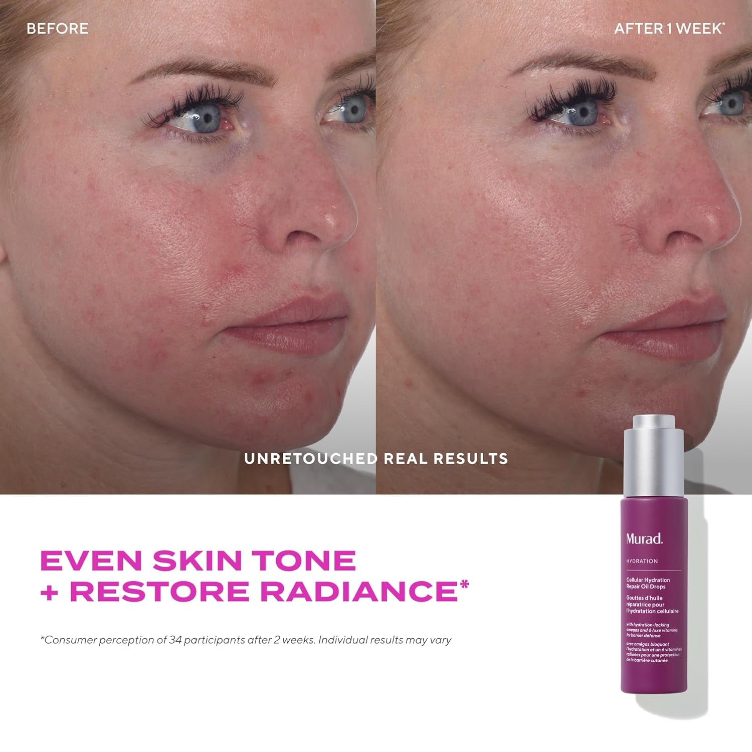 Murad Cellular Hydration Repair Oil Drops – 30ml | Fast-Absorbing Hydrating Facial Oil