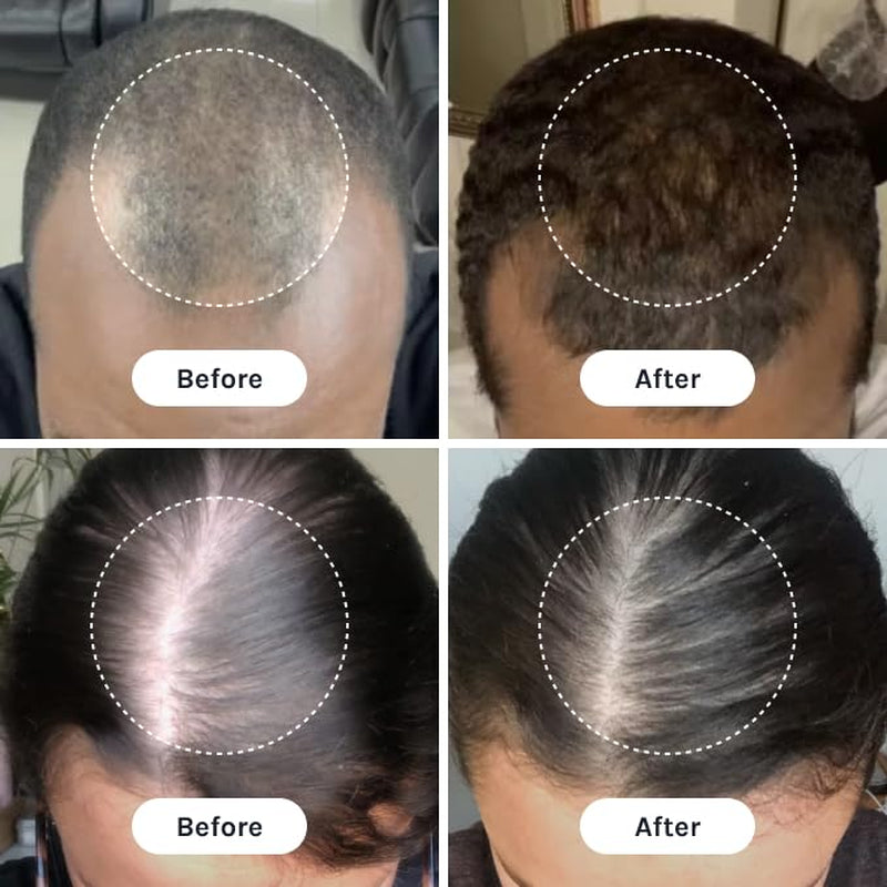 PTD-DBM Peptide Hair Serum for Fuller-Looking Hair - Scalp Treatment for Visible Growth & Follicle Renewal - Reinforce Restoration, Strand Integrity & Optimal Density (25 Ml)